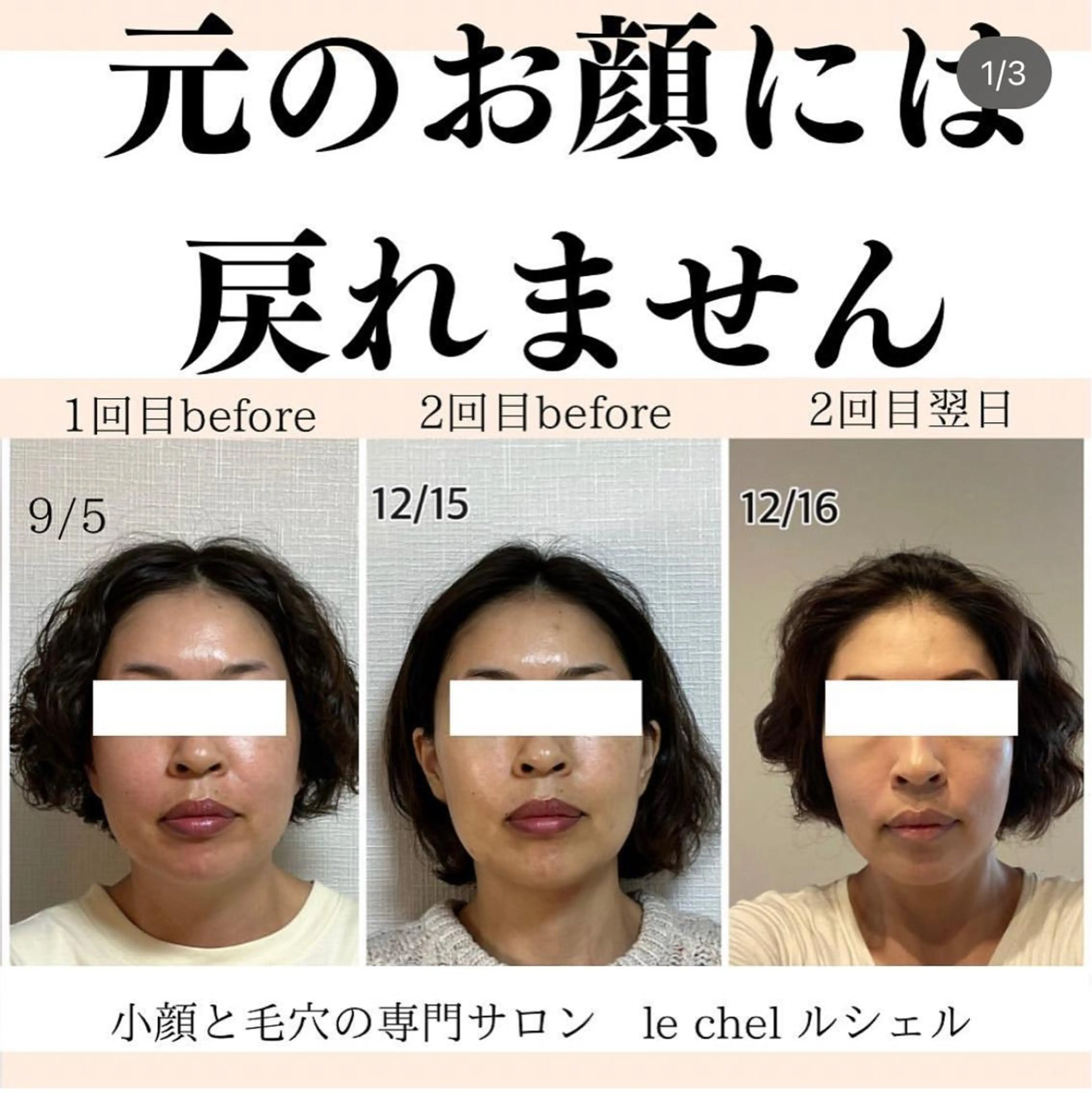 小顔・毛穴専門 ルシェルのエステ・リラクイメージ