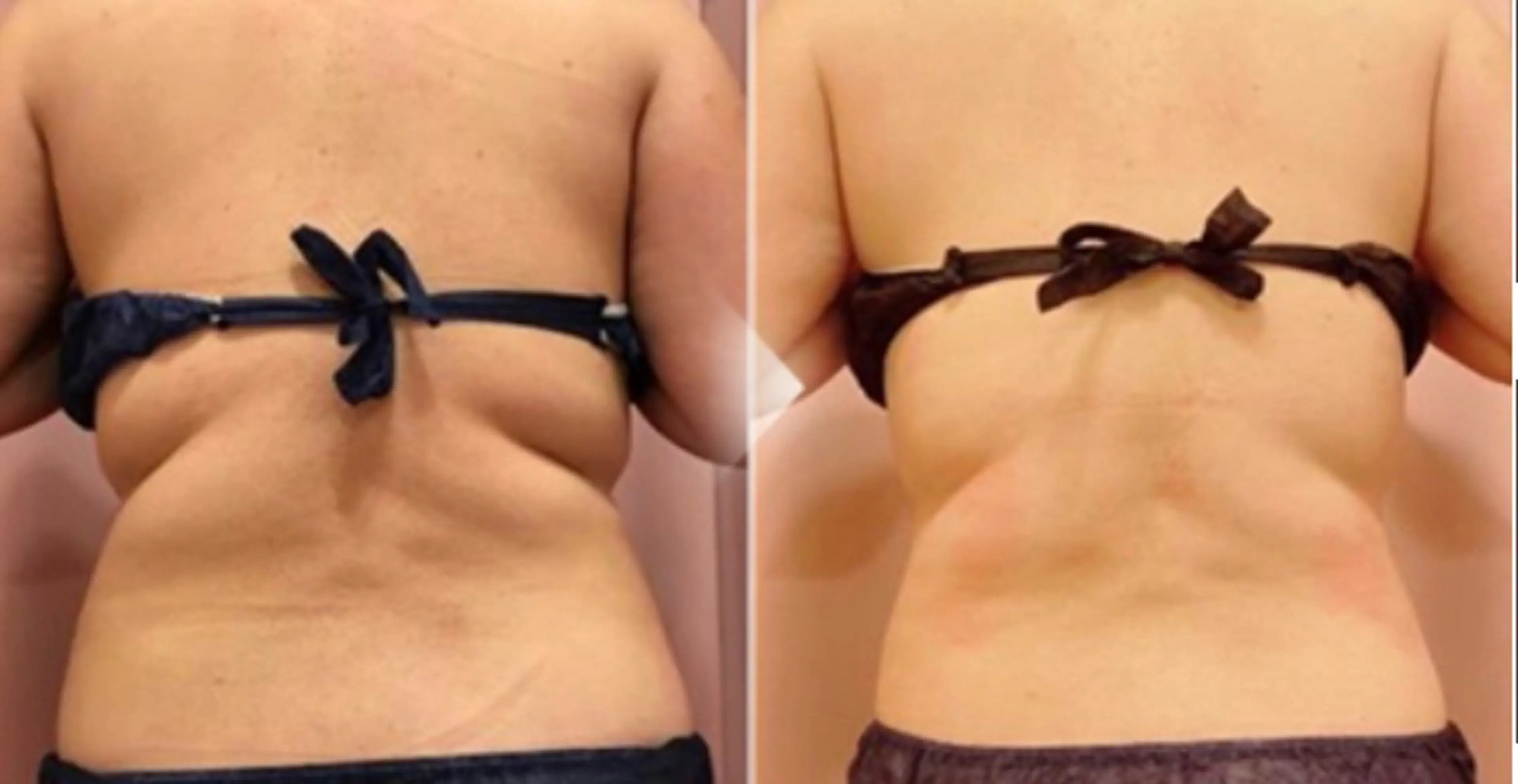 エステ salon de MOREのエステ・リラクイメージ