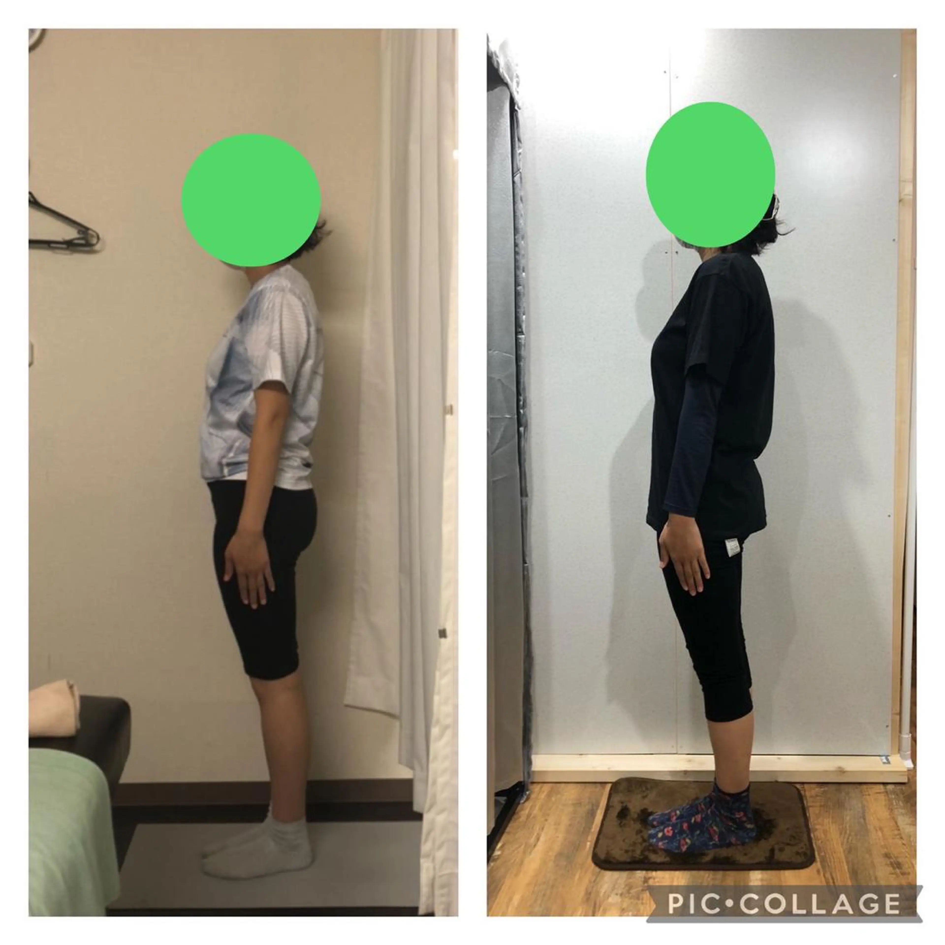 ☆気になる骨盤の歪みや出っ張り☆脚痩せ/ヒップアップに効果的☆骨盤矯正　整体の写真