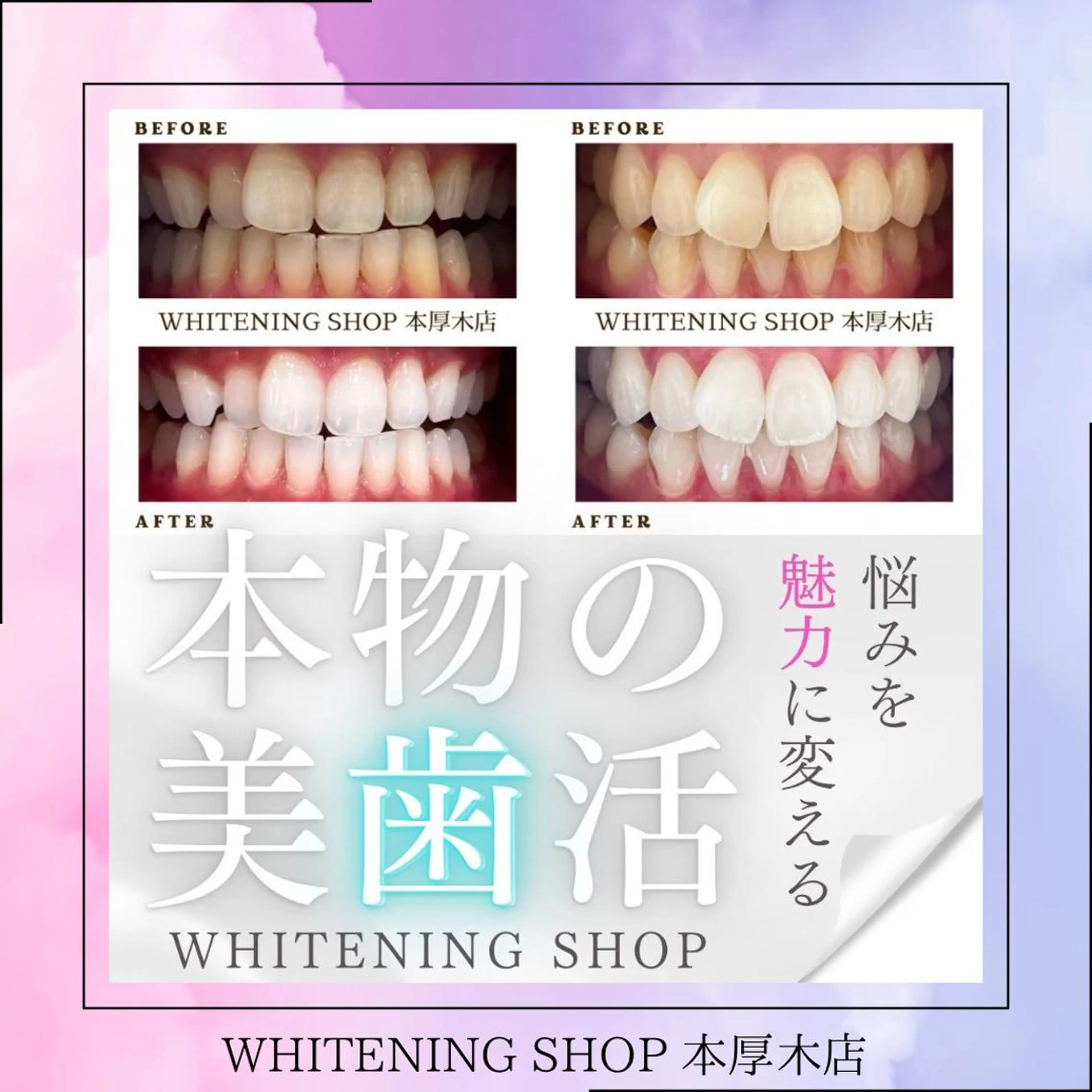 メンズ その他 ホワイトニング ショップ本厚木のその他イメージ