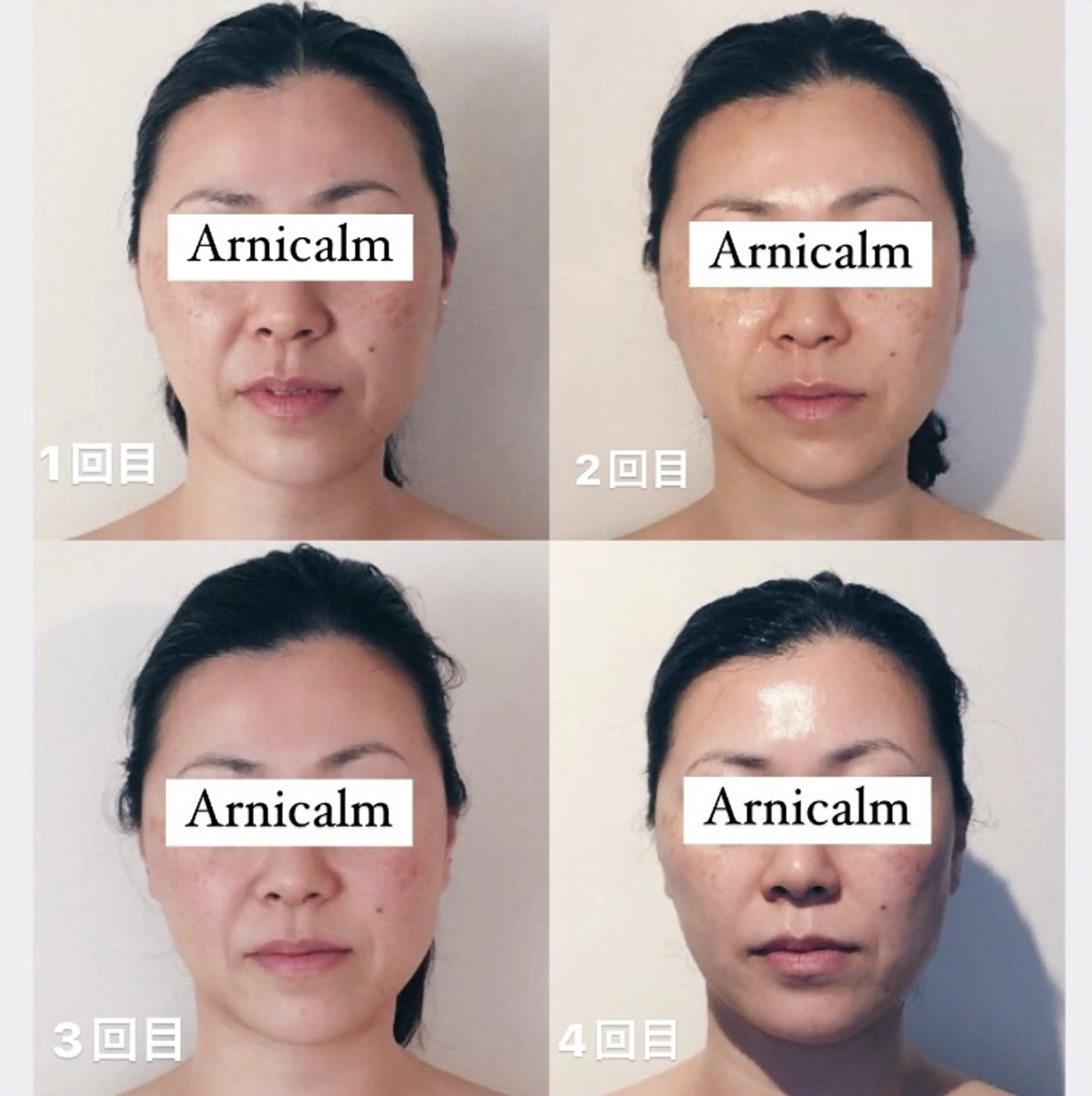 ハーブピーリング 肌再生ピーリング/のエステ・リラクイメージ