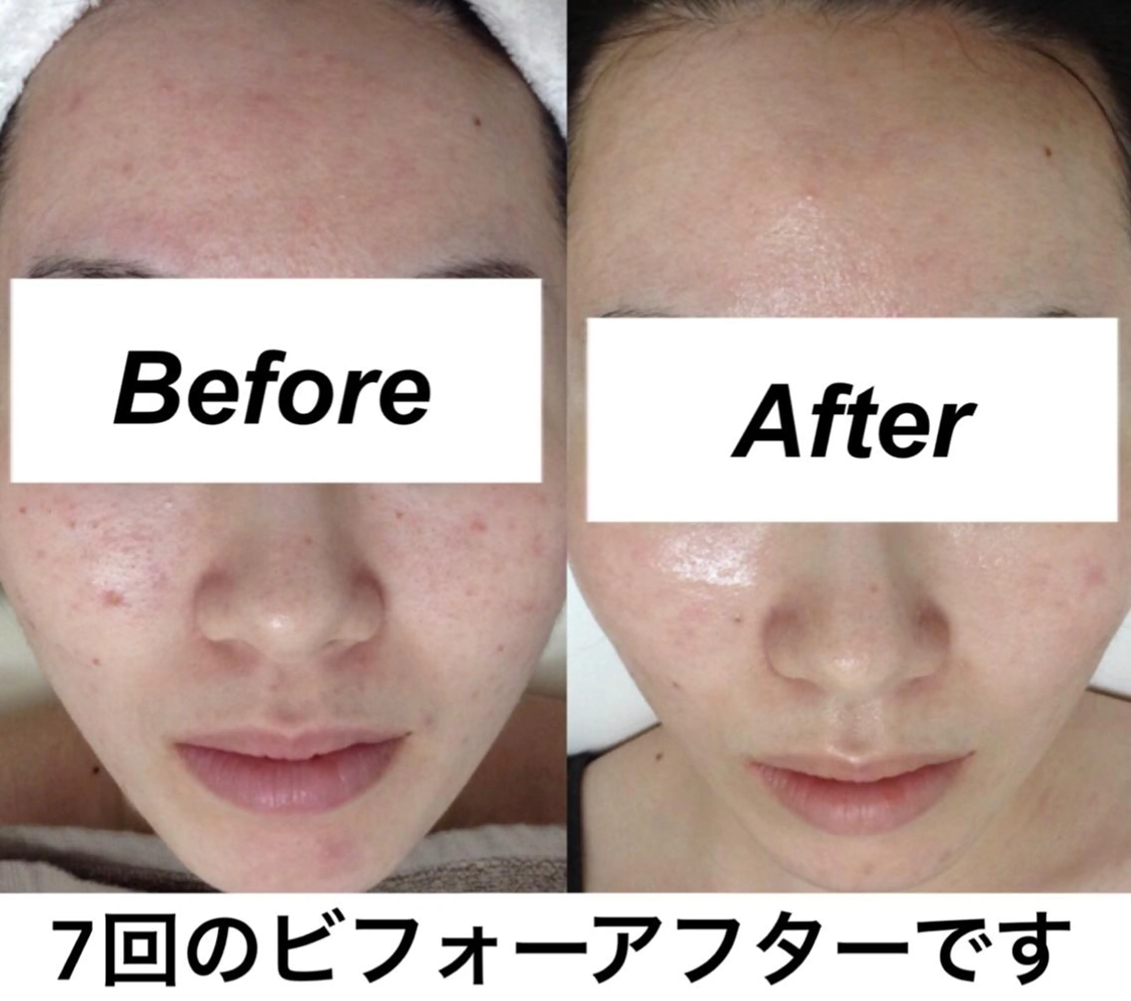 エステ リラク 都度払い肌質改善 &脱毛Blancheのエステ・リラクイメージ