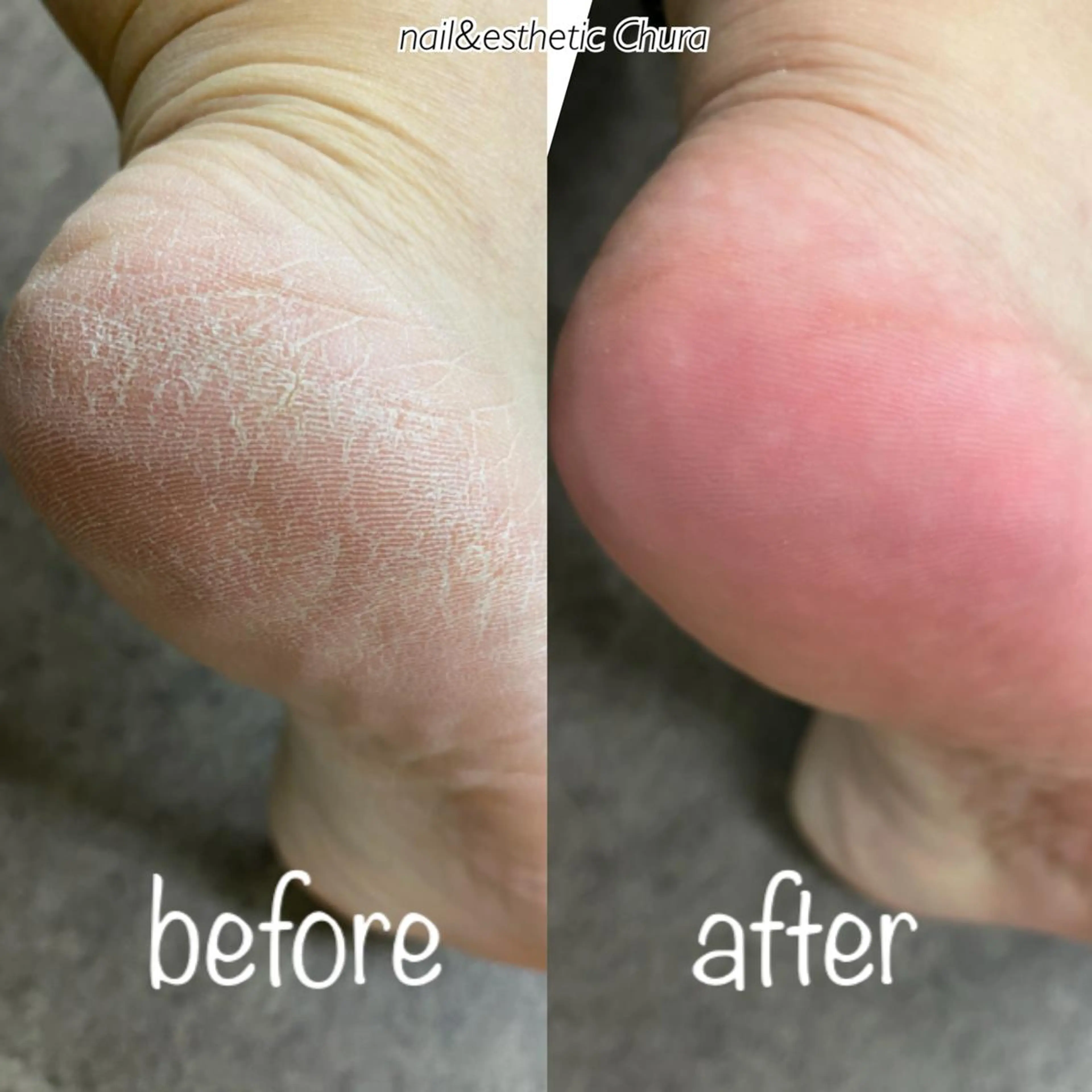 ネイル フットネイル chura刈谷店☆ Ｎａｉｌのネイルデザイン