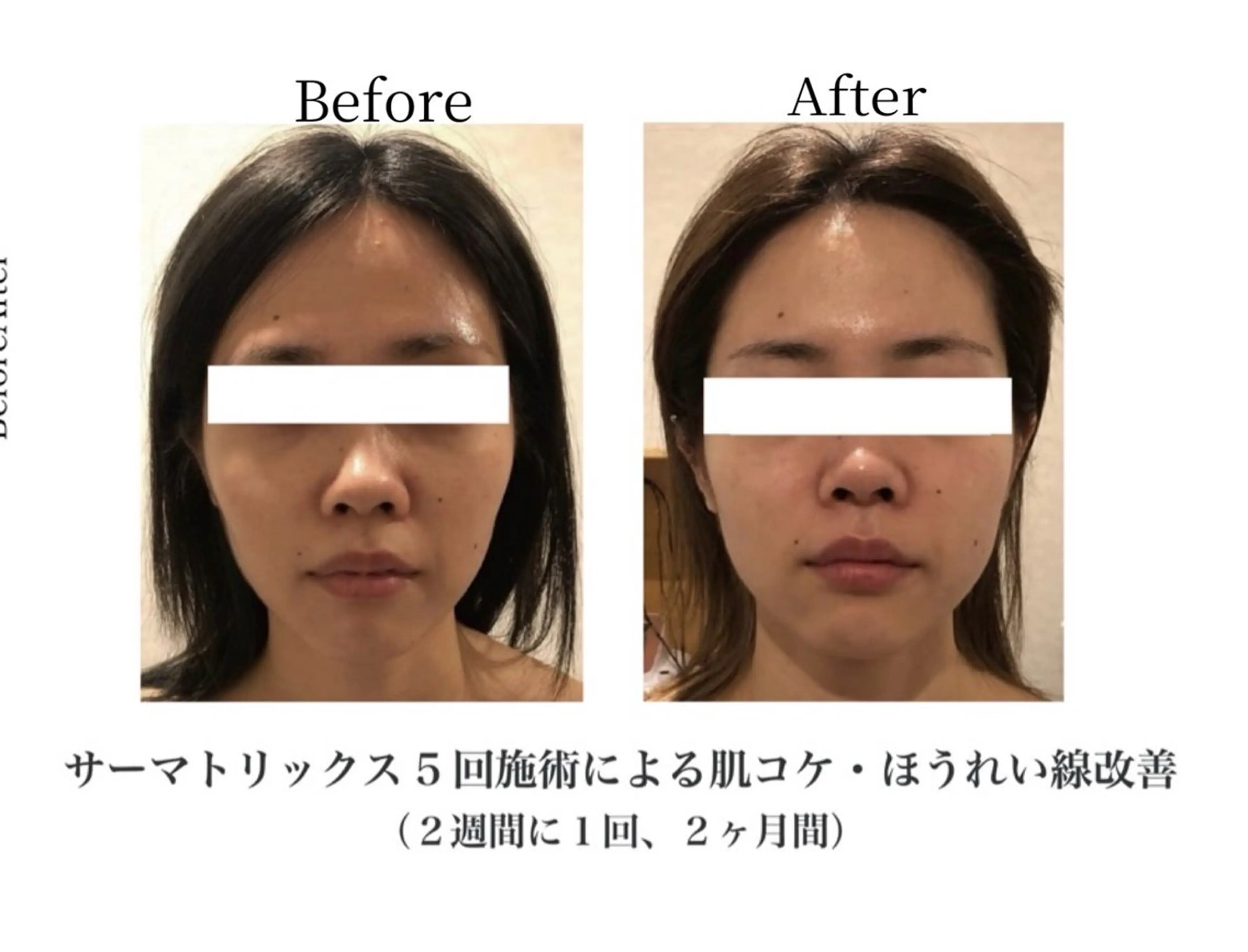 エステ 🌟看護師が施術🪄 ナスサロ/狩野のエステ・リラクイメージ