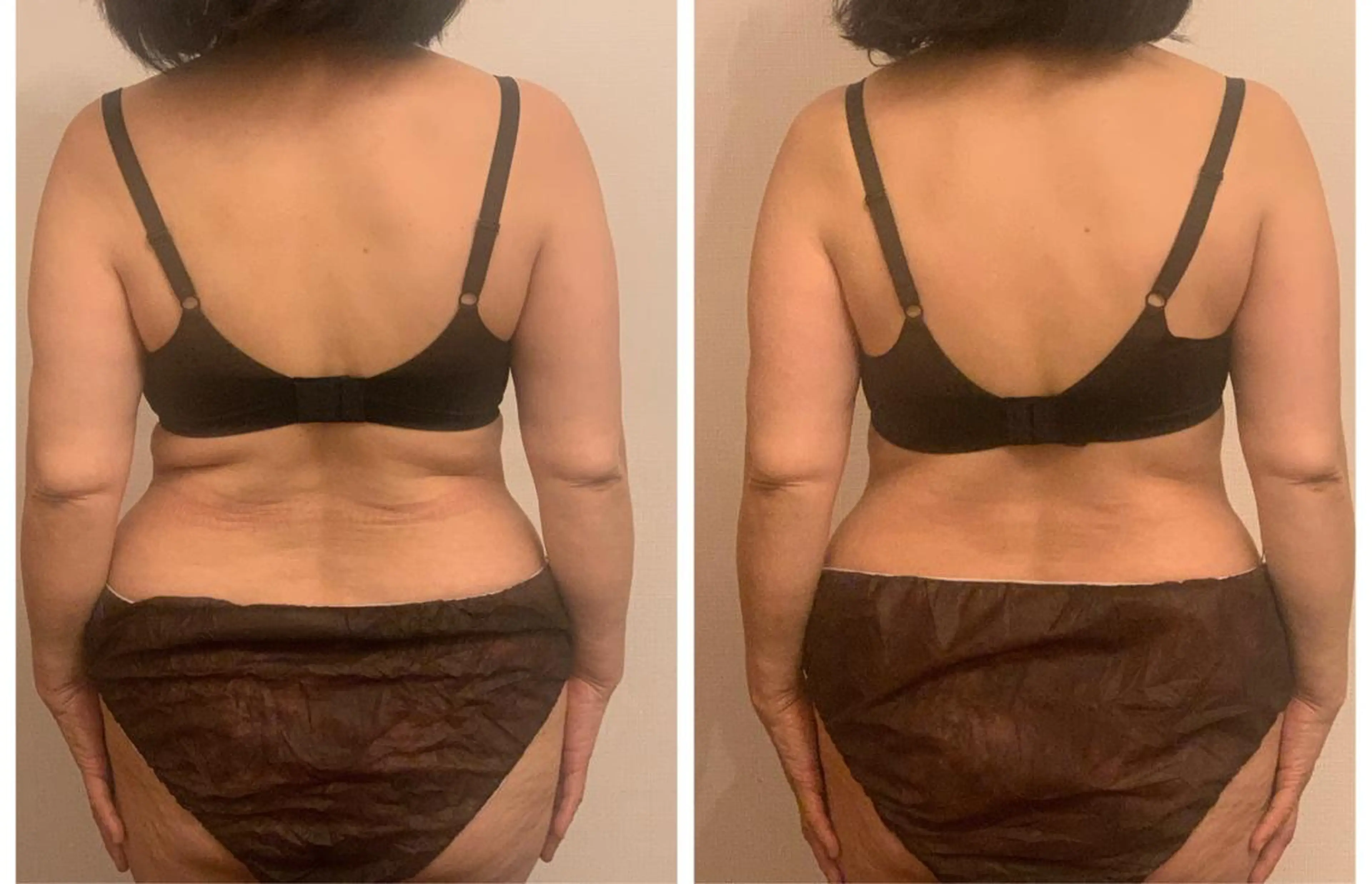 エステ リラク アンベリーノ Yuuriのエステ・リラクイメージ