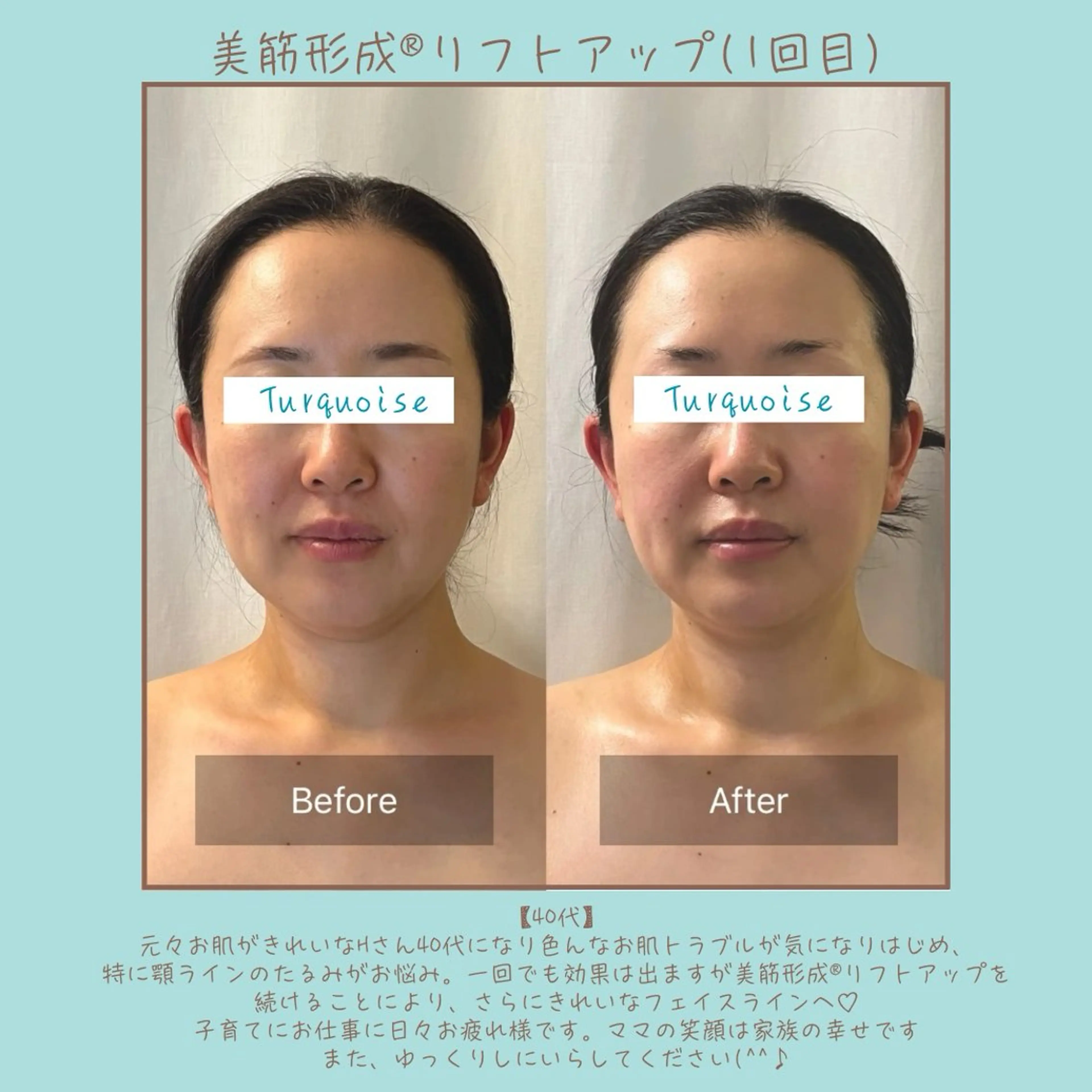 フェイシャルエステ Turquoiseのエステ・リラクイメージ