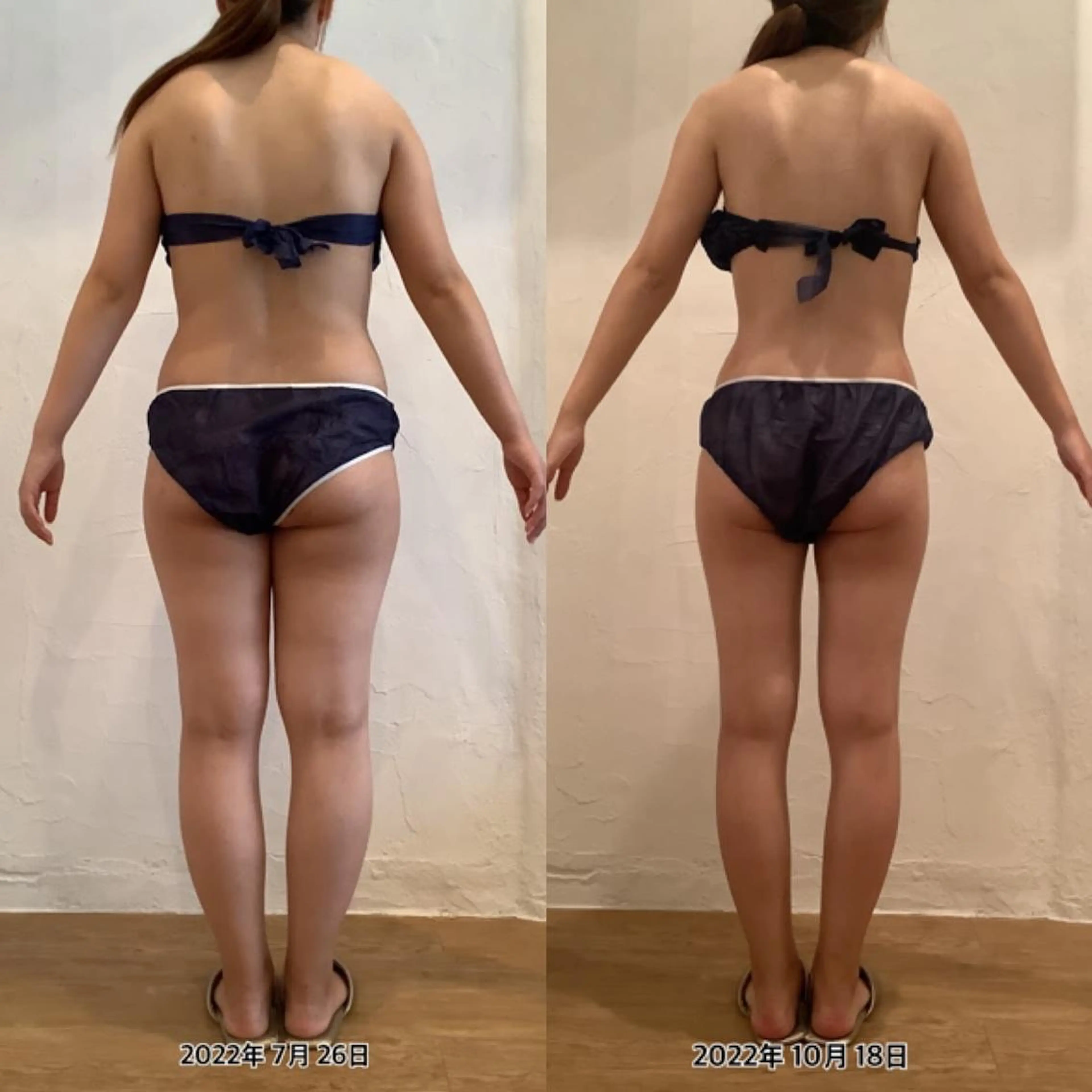 【本気ダイエット🔥】ずっと気になってる😭今度こそコンプレックス解消で自分に自信を🩵ほっそりした自分に出会う✨の写真