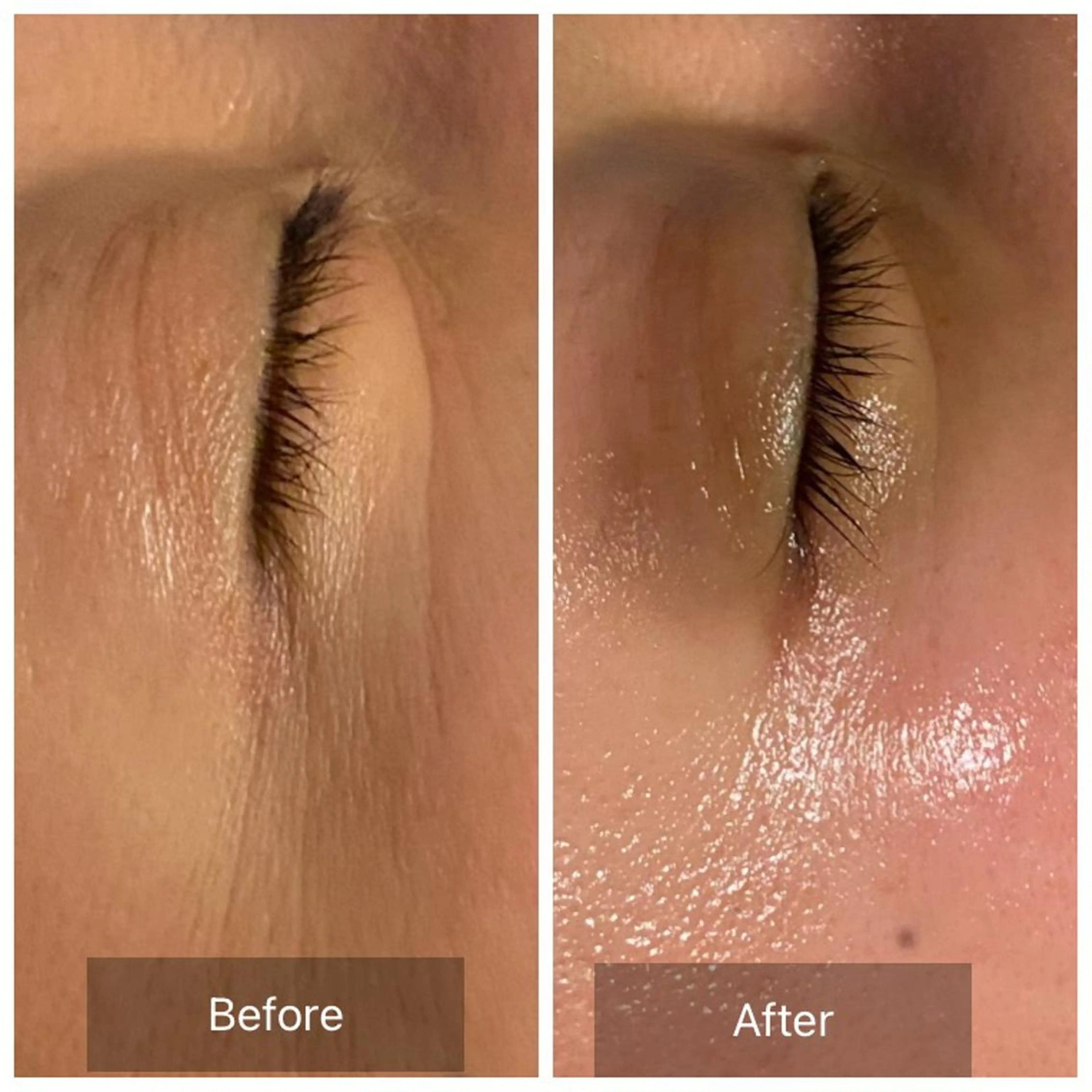 韓国モデル❤️小顔陶器肌コース【メラニンを含む古い角質毛穴汚れ除去💎】お茶カウンセリング込120分の写真