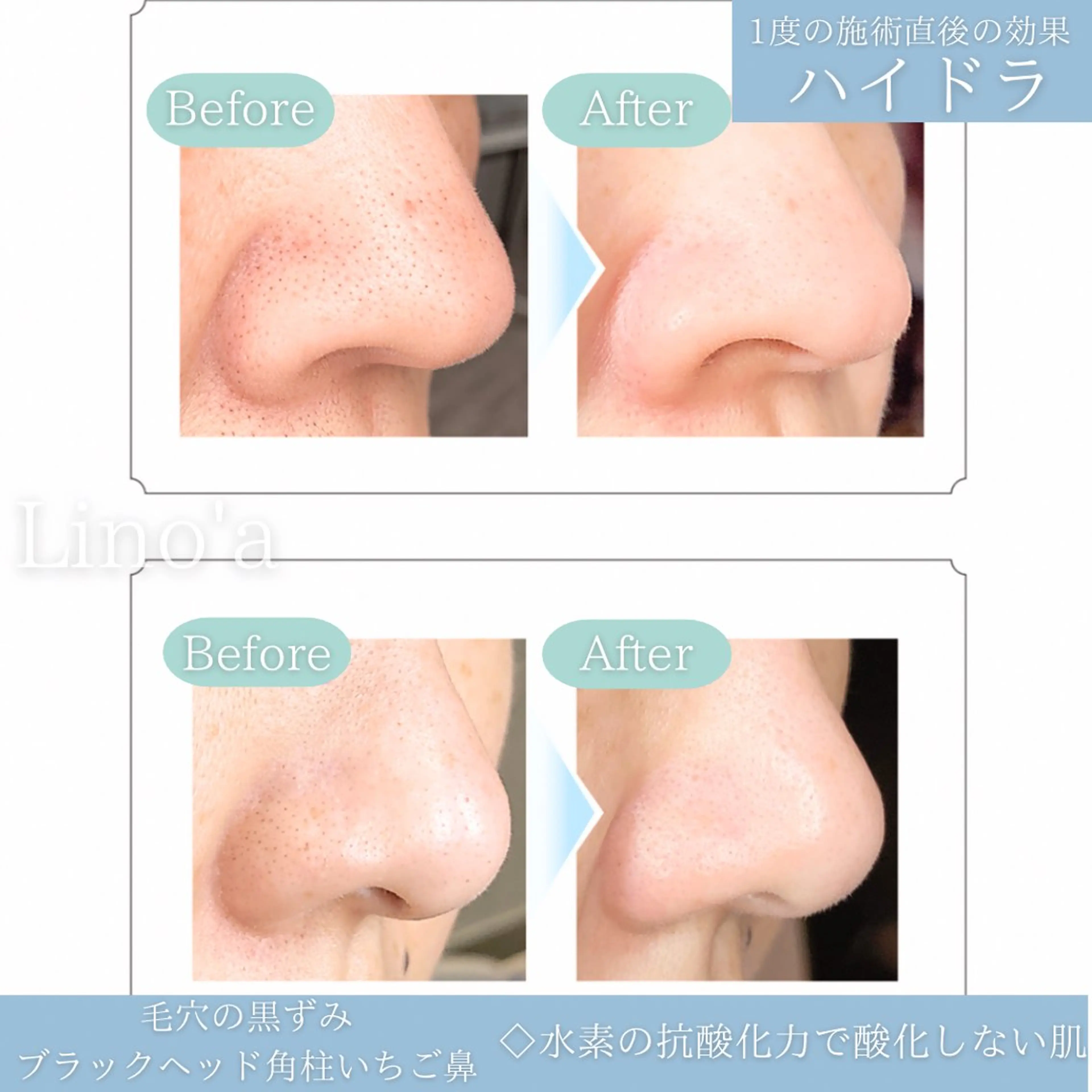 Salon💫 Lino'a柏店のエステ・リラクイメージ