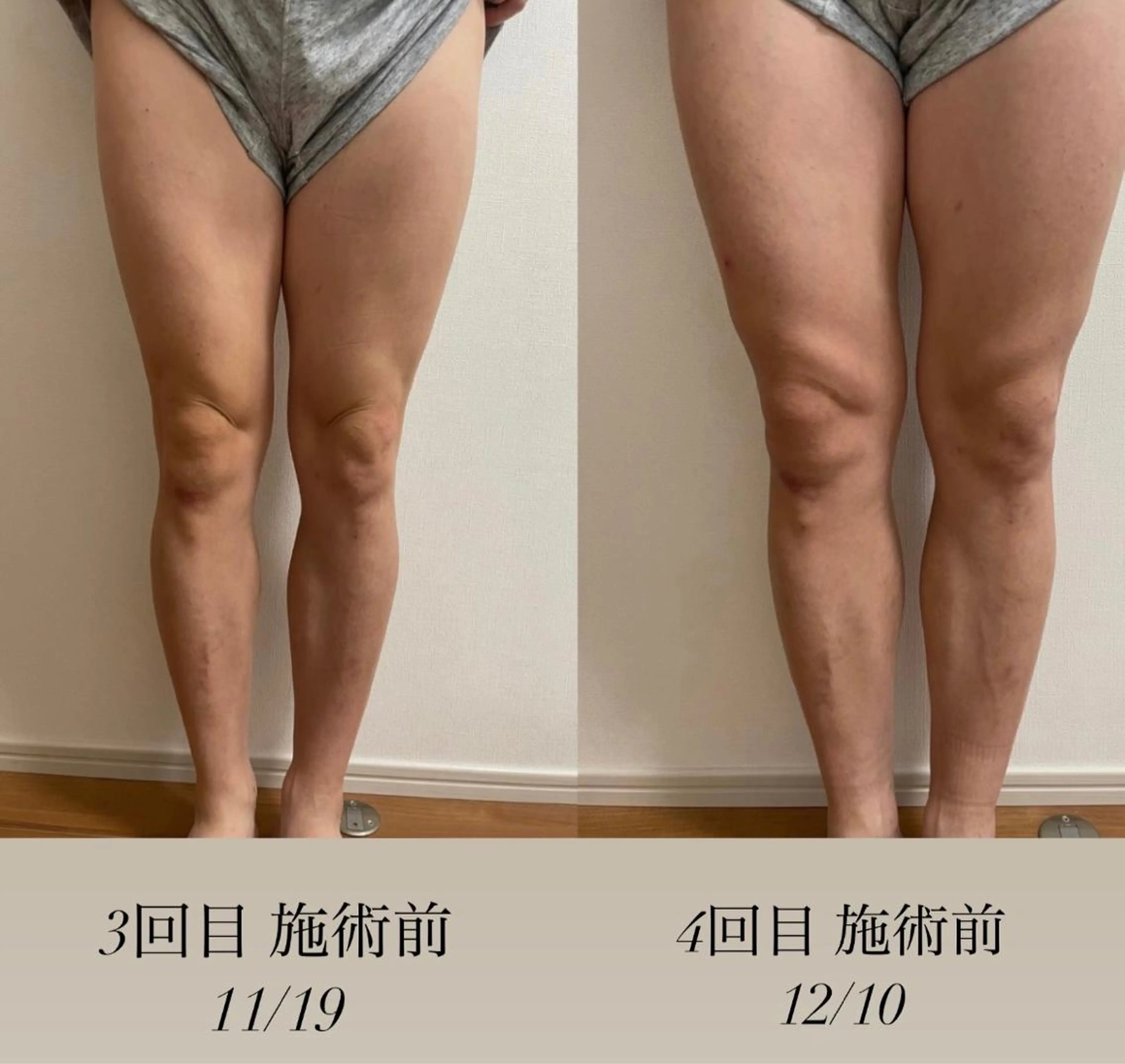 脱毛 エステサロン Mi-mi.iのエステ・リラクイメージ