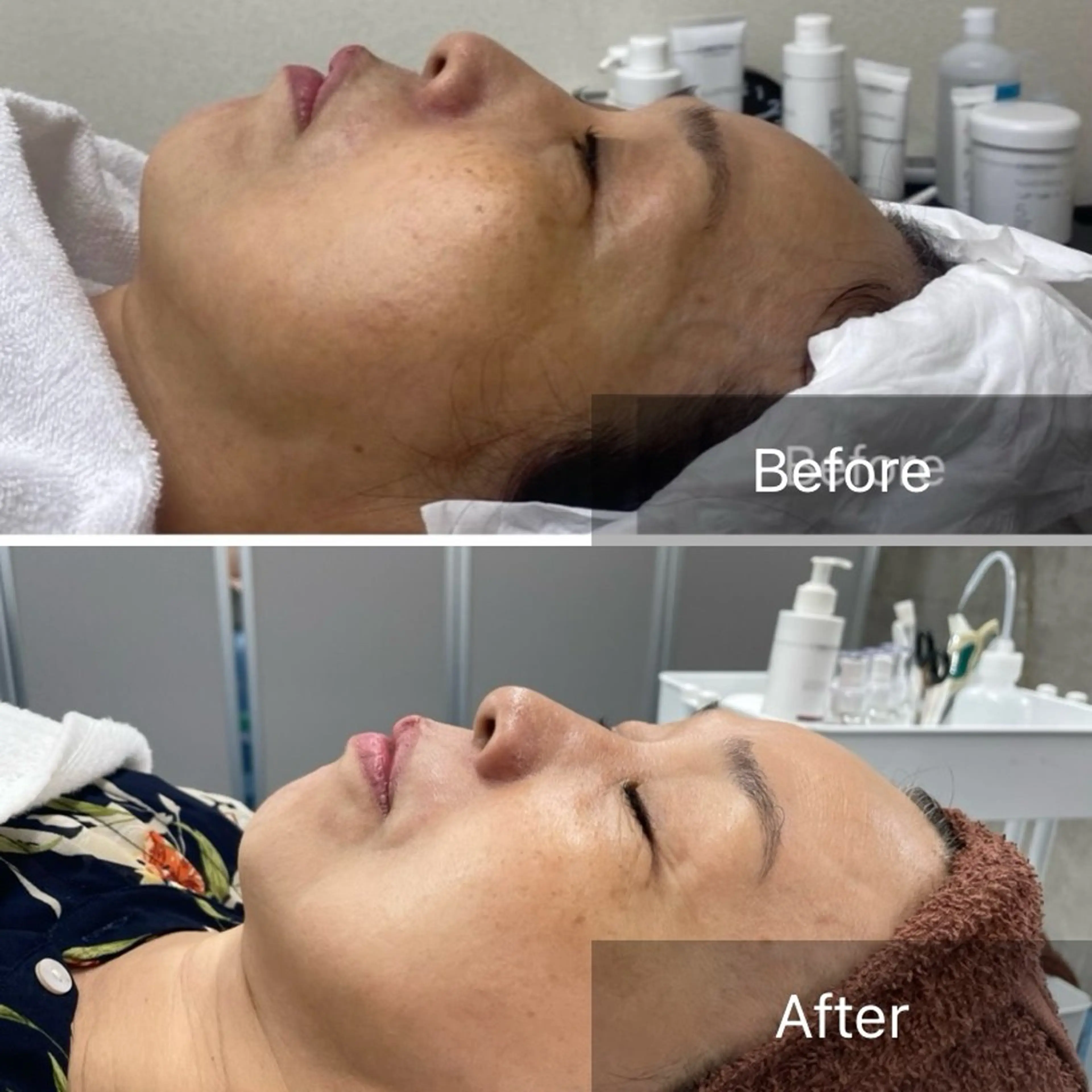 Lis Rose🥀 フェイシャルサロンのエステ・リラクイメージ