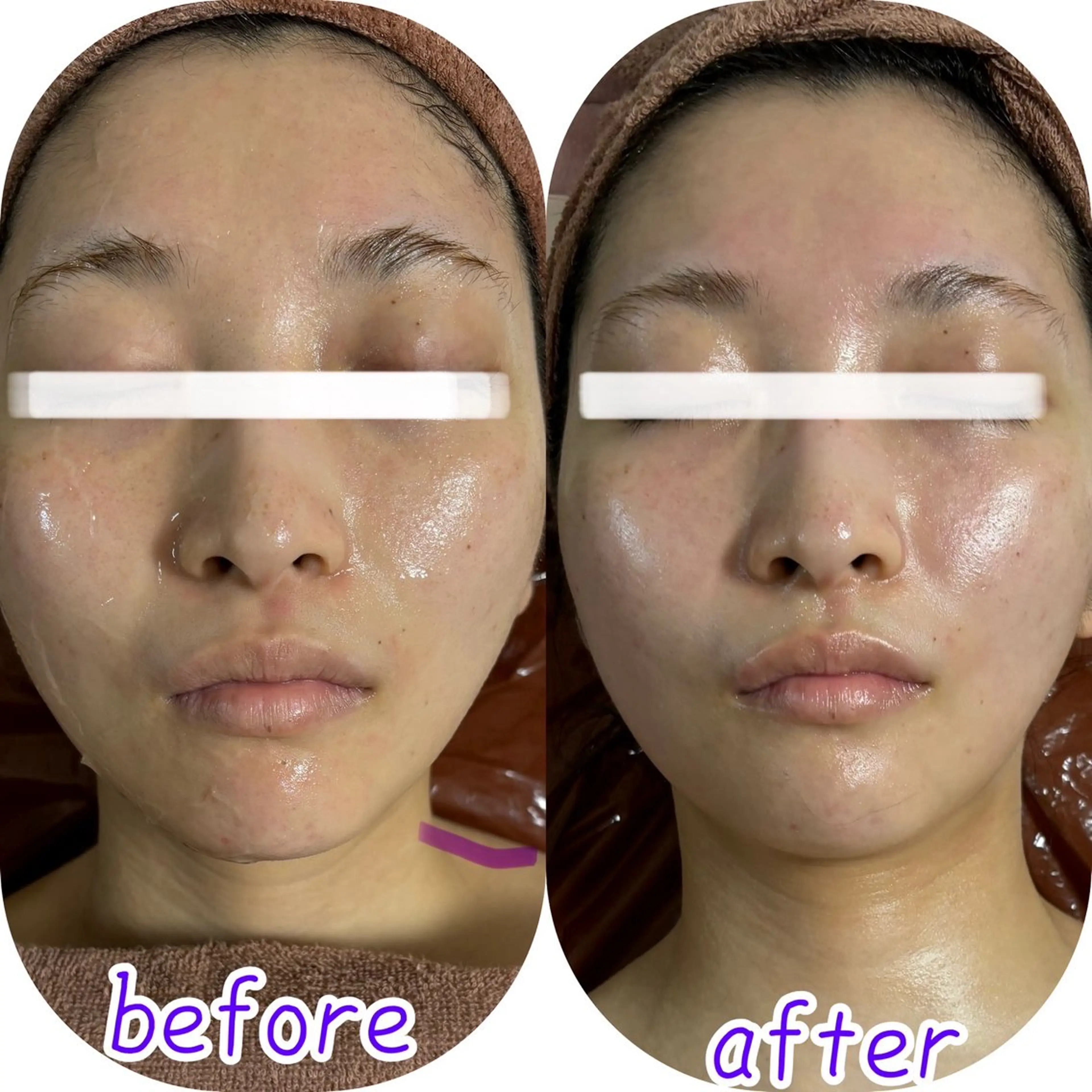 エステ リラク Linomalie エステ/たるみ/脱毛のエステ・リラクイメージ