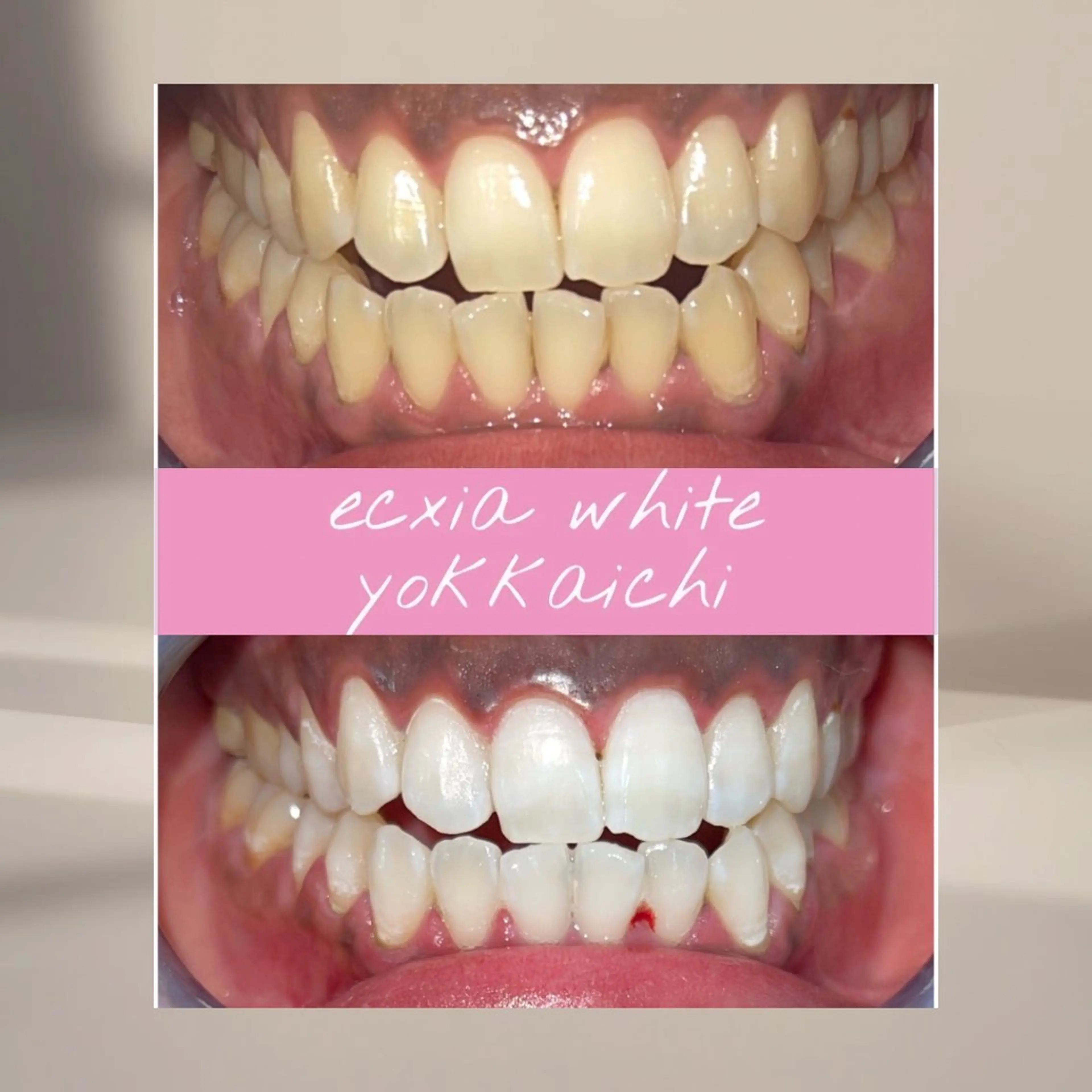 ホワイトニングサロン エクシア四日市店のその他イメージ