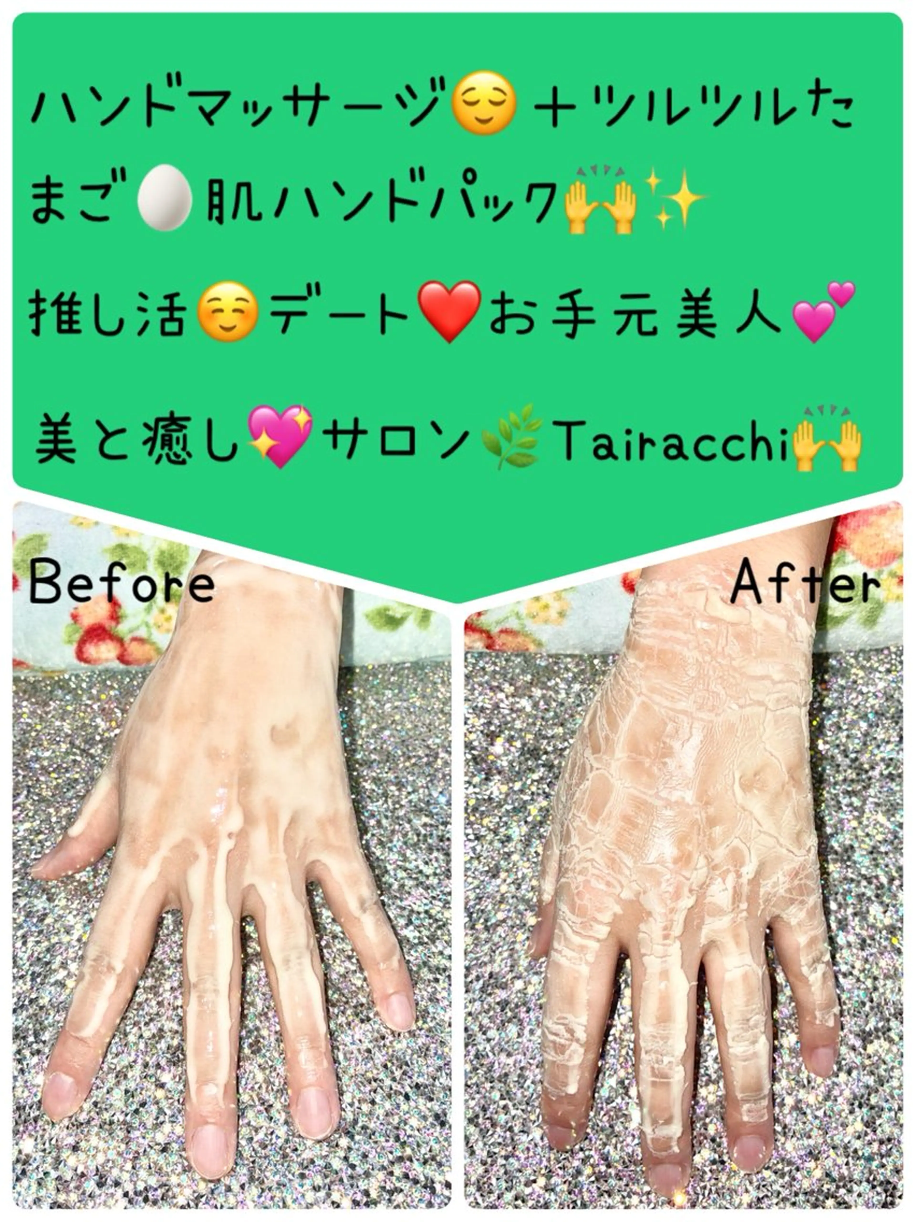 ネイル ハンドネイル ハンドケア Tairacchi ﾀｲﾗｯﾁのエステ・リラクイメージ