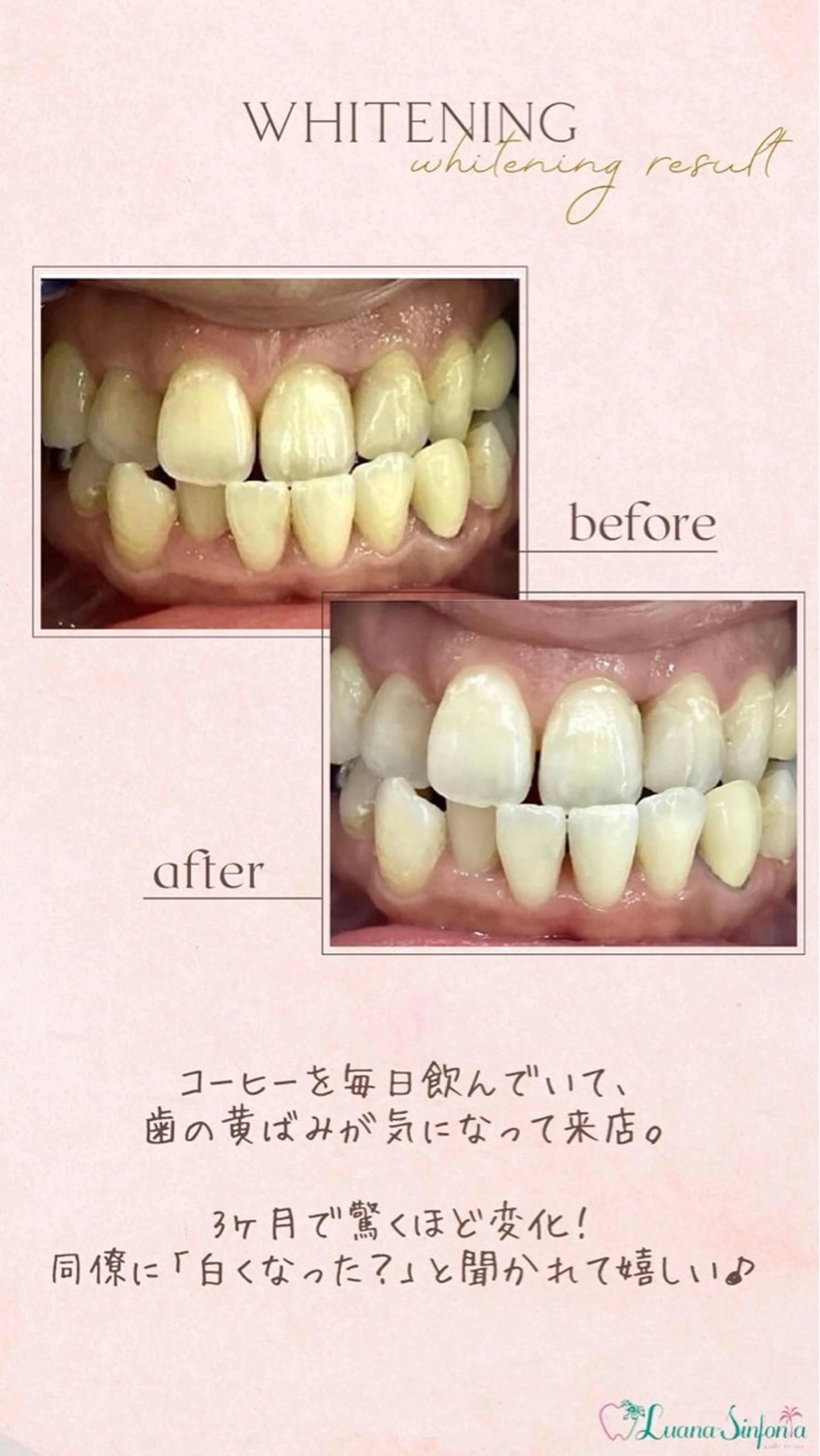 橋口 花菜子のその他イメージ