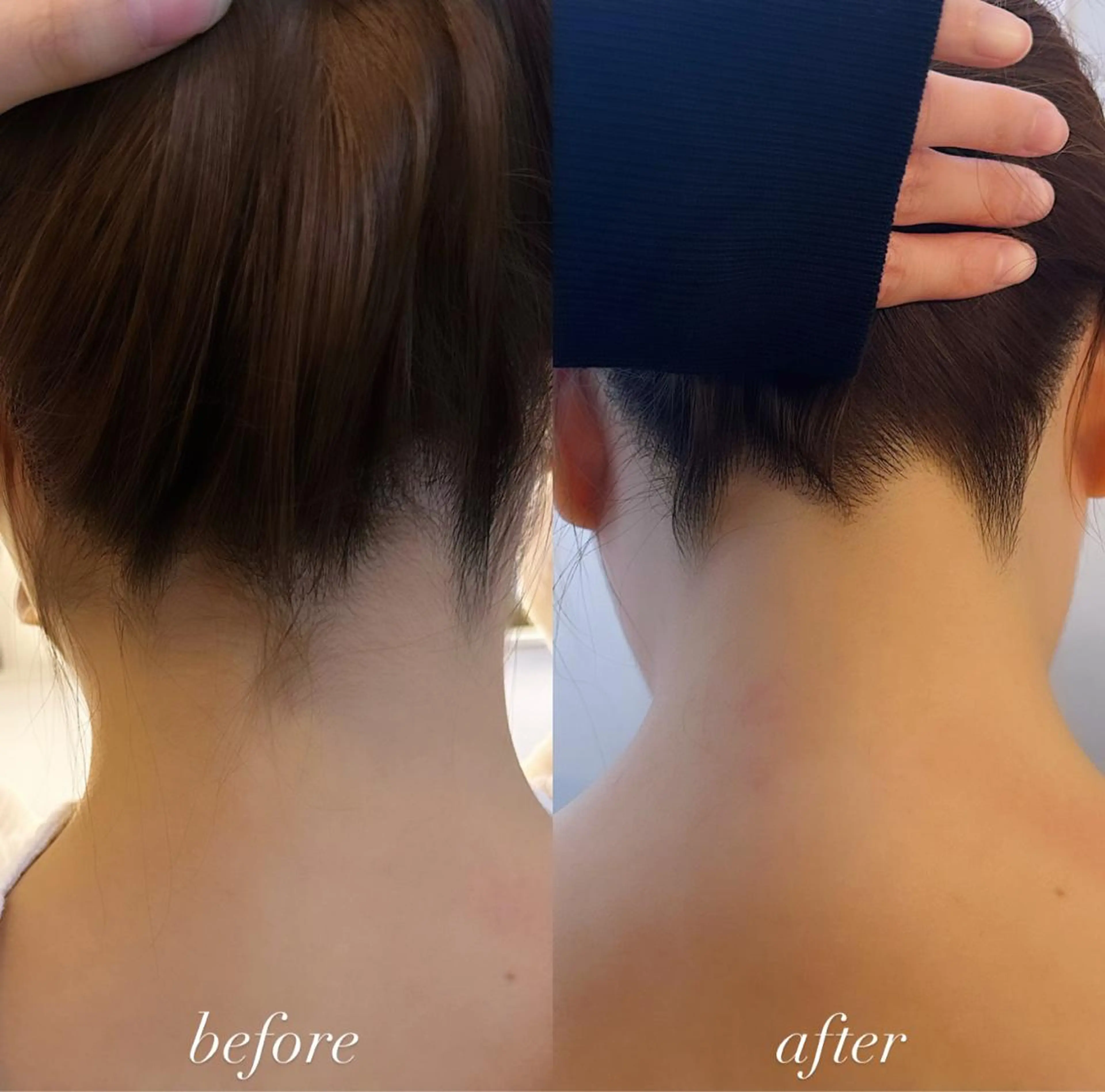 うなじ脱毛/美肌脱毛 LABELのエステ・リラクイメージ