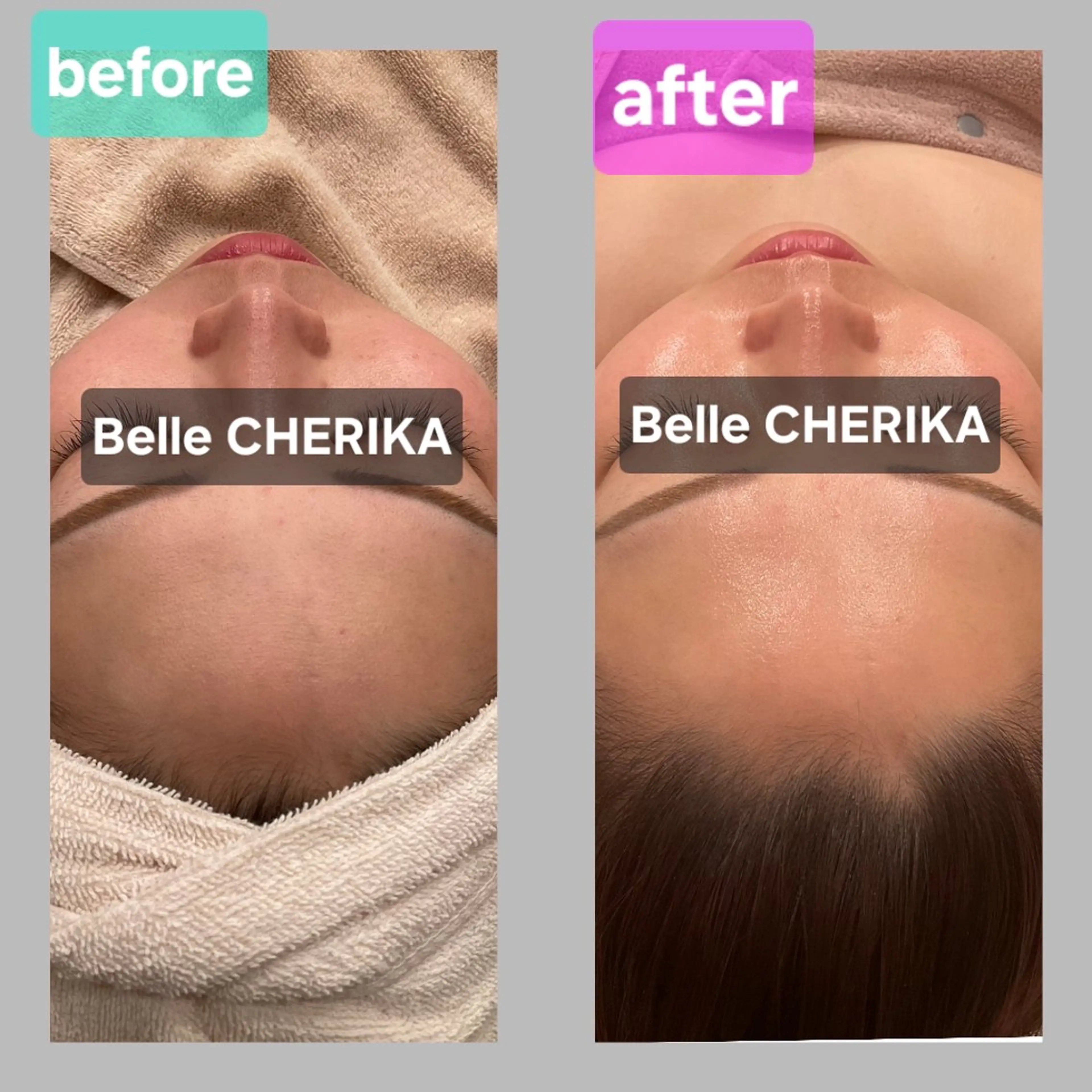 エステ ベル チェリカ 三城のエステ・リラクイメージ