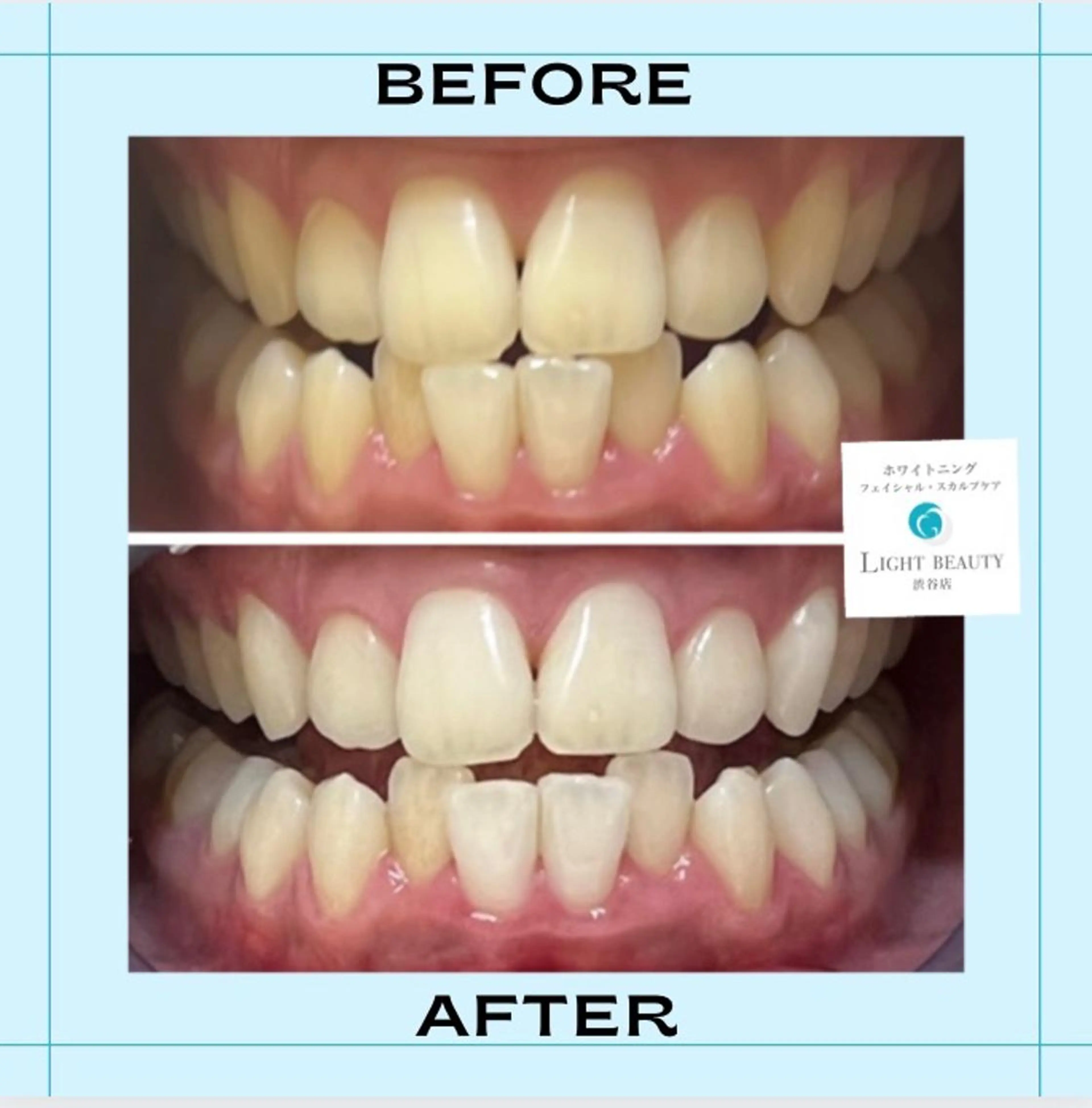 その他 ライトビューティー渋谷本店所属・ライトビューティー 渋谷本店のその他イメージ