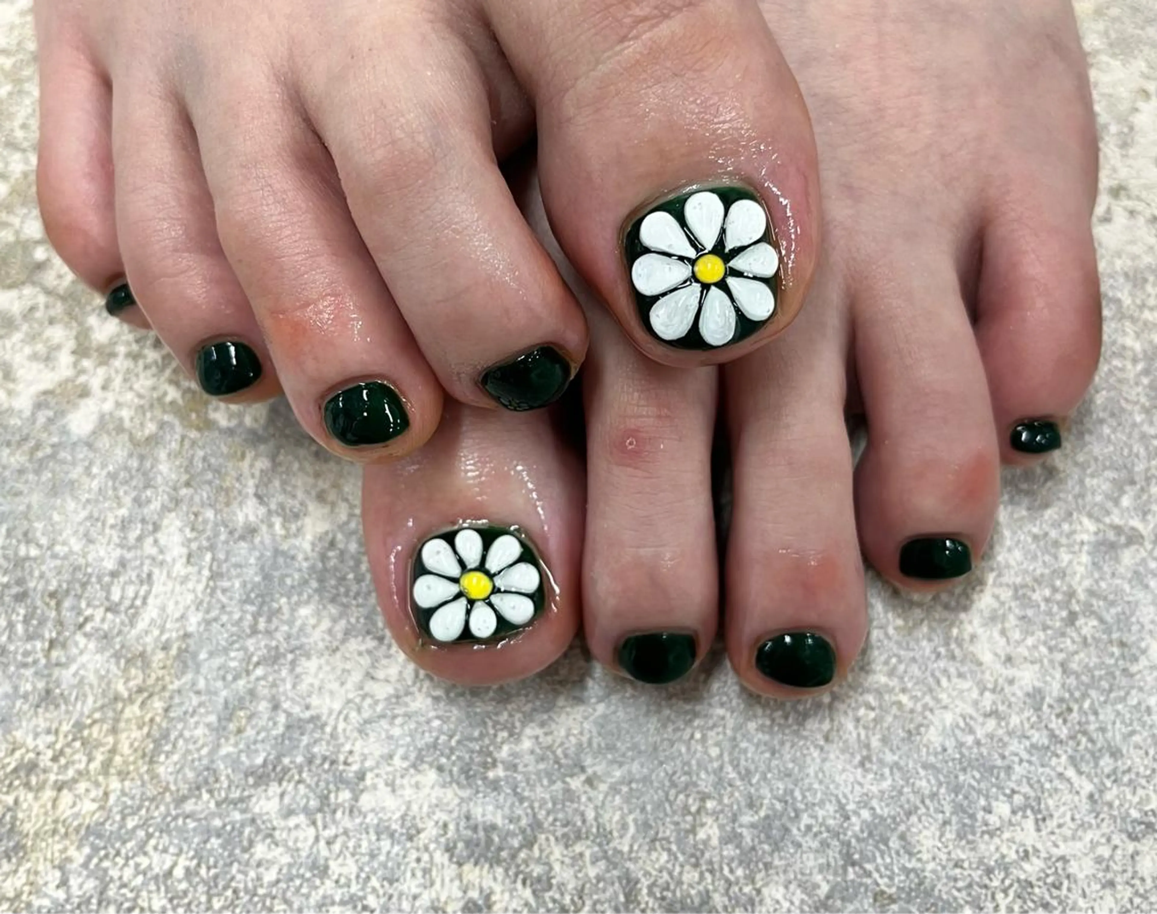 ネイル フットネイル Basic町田本店 Suzunaのネイルデザイン