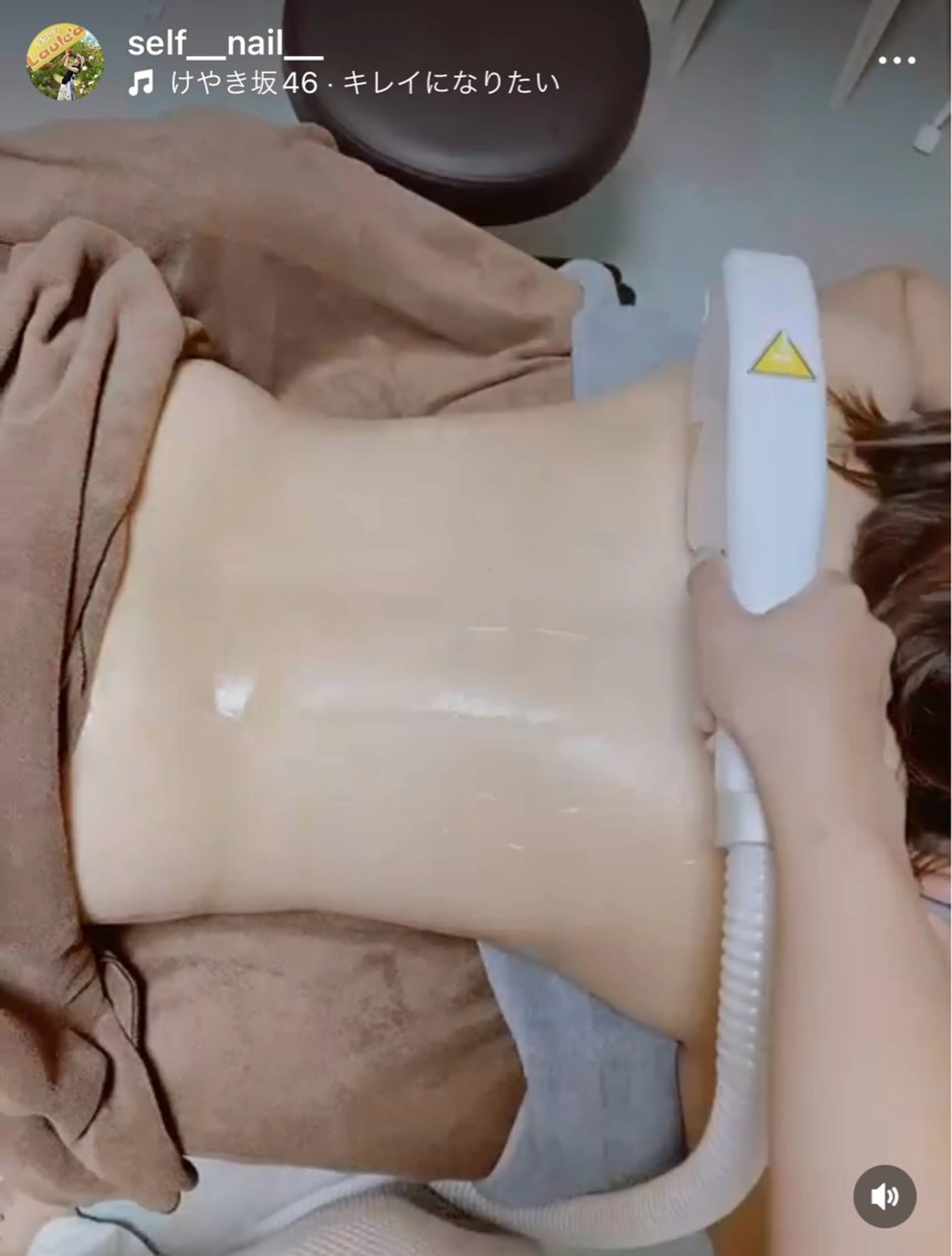 初回脱毛無料キャンペーン❗️の写真