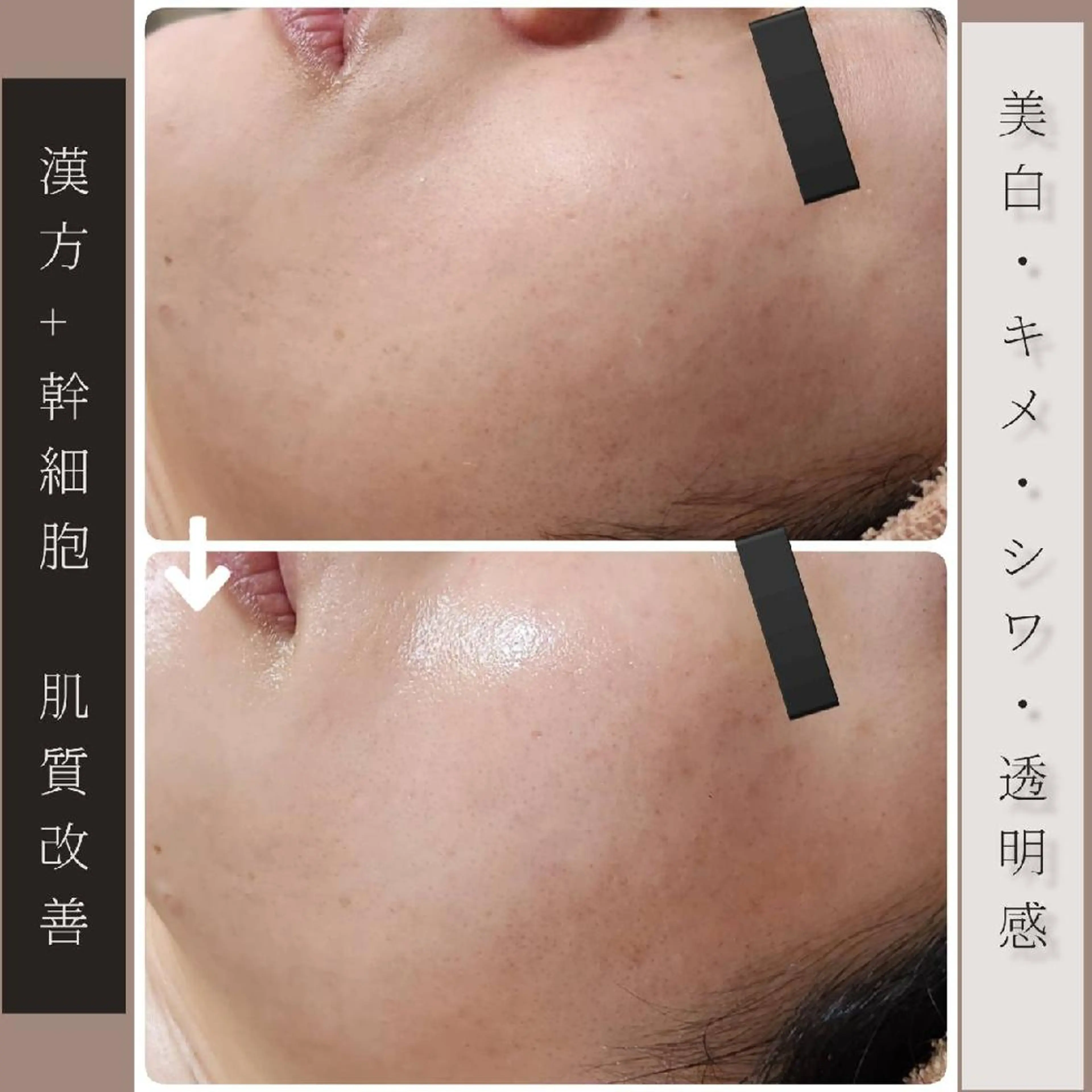 エステ リラク Glossy salonのエステ・リラクイメージ