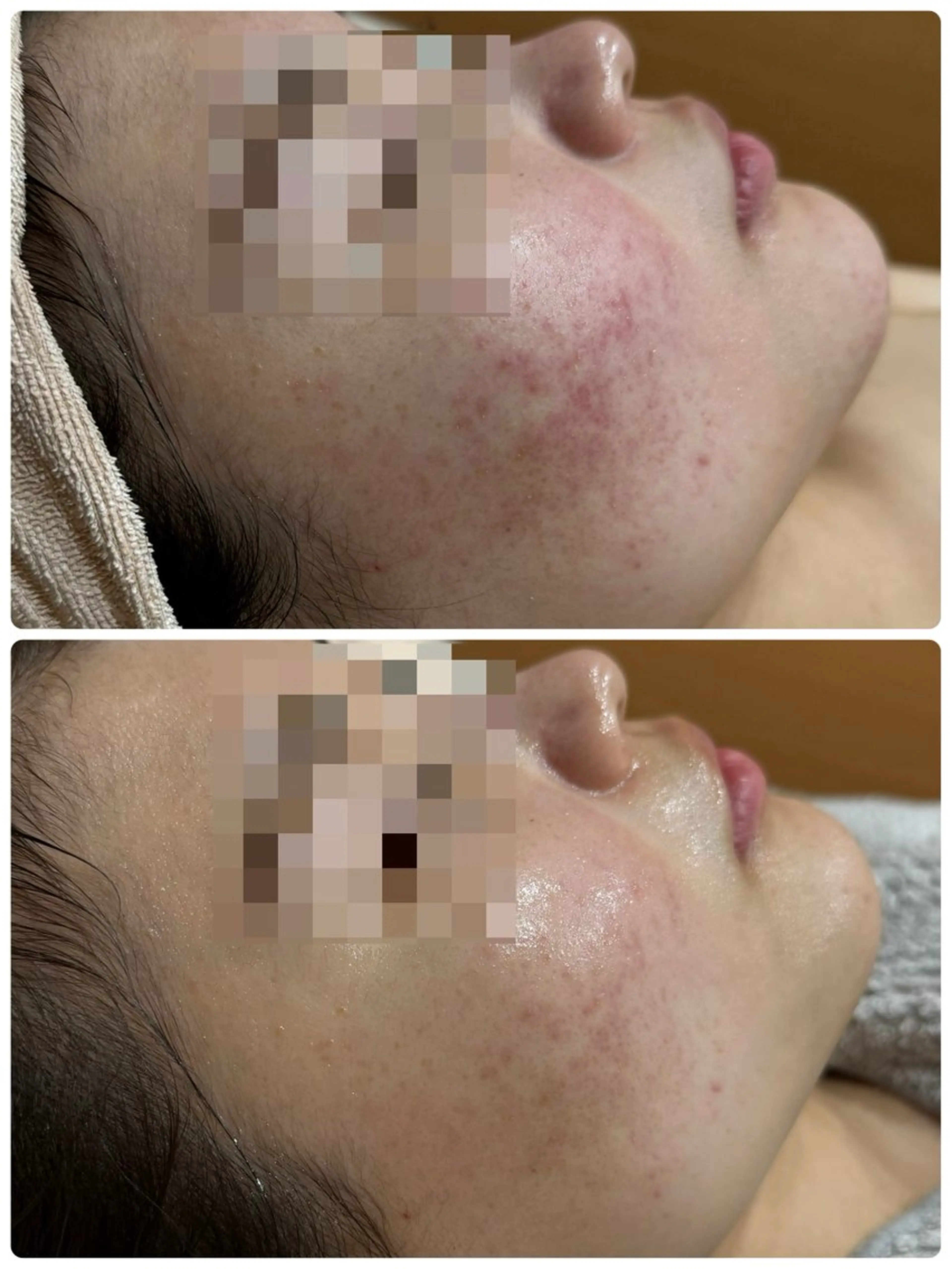 エステ 脱毛&フェイシャル 専門店muro.のエステ・リラクイメージ