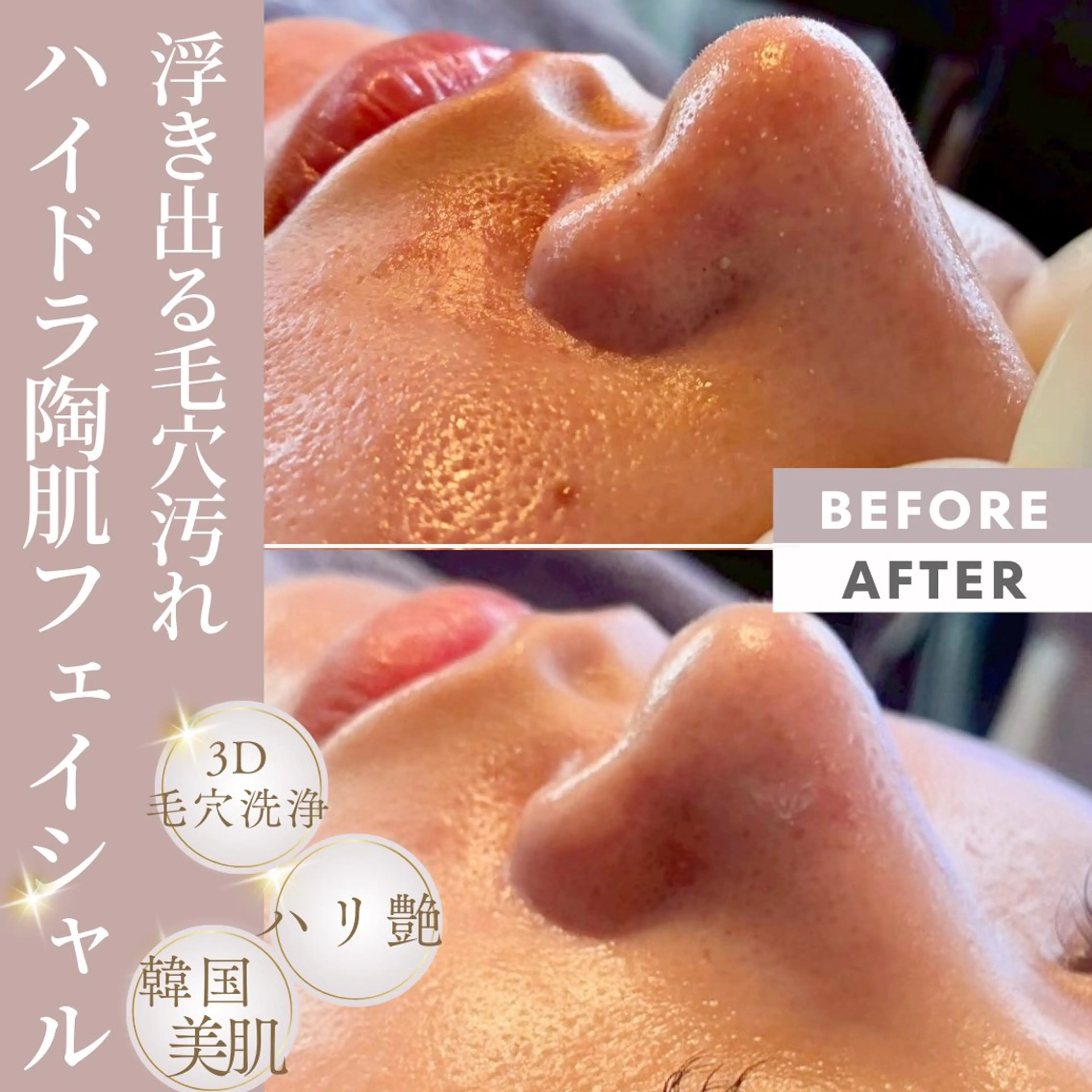 🆕２回目以降の方☺️黒ずみ毛穴が気になる方へ🌺【毛穴洗浄&引き締めフェイシャル】【メンズも大歓迎⭕️】の写真