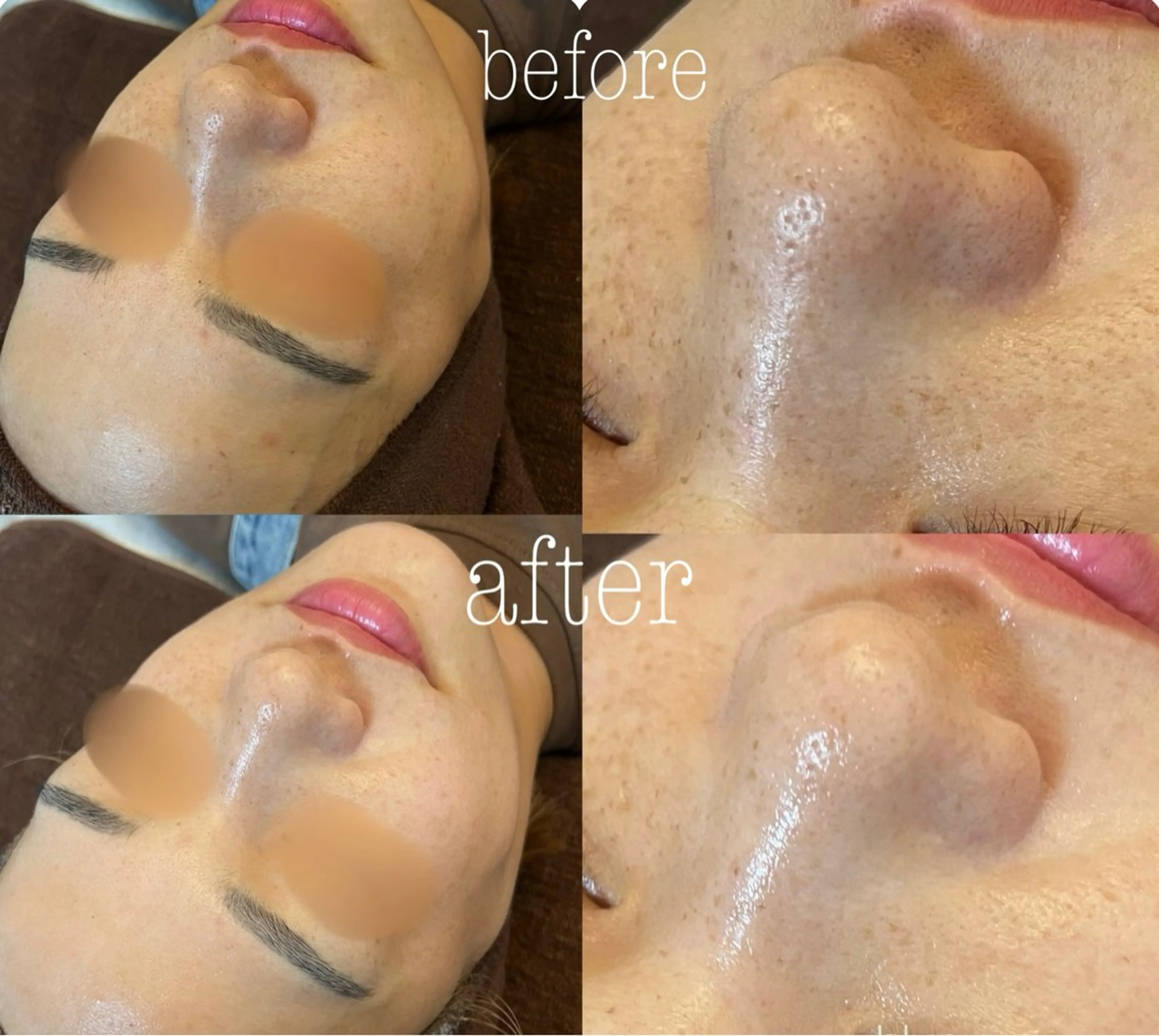 エステ 肌質改善|美眉サロンCannone'所属・肌質改善|美眉サロン Cannone’のエステ・リラクイメージ