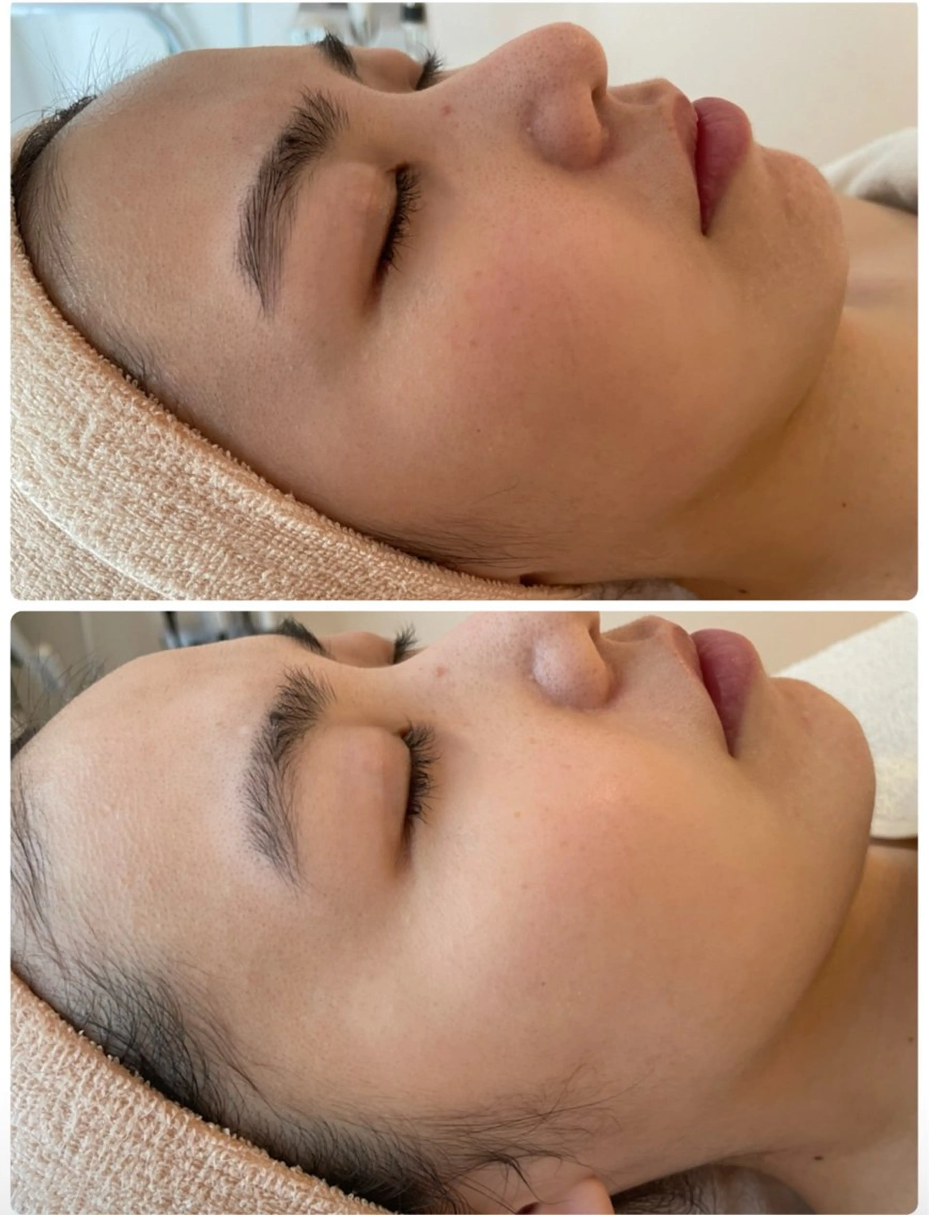 久屋大通ツヤ肌エステ KIMURAのエステ・リラクイメージ