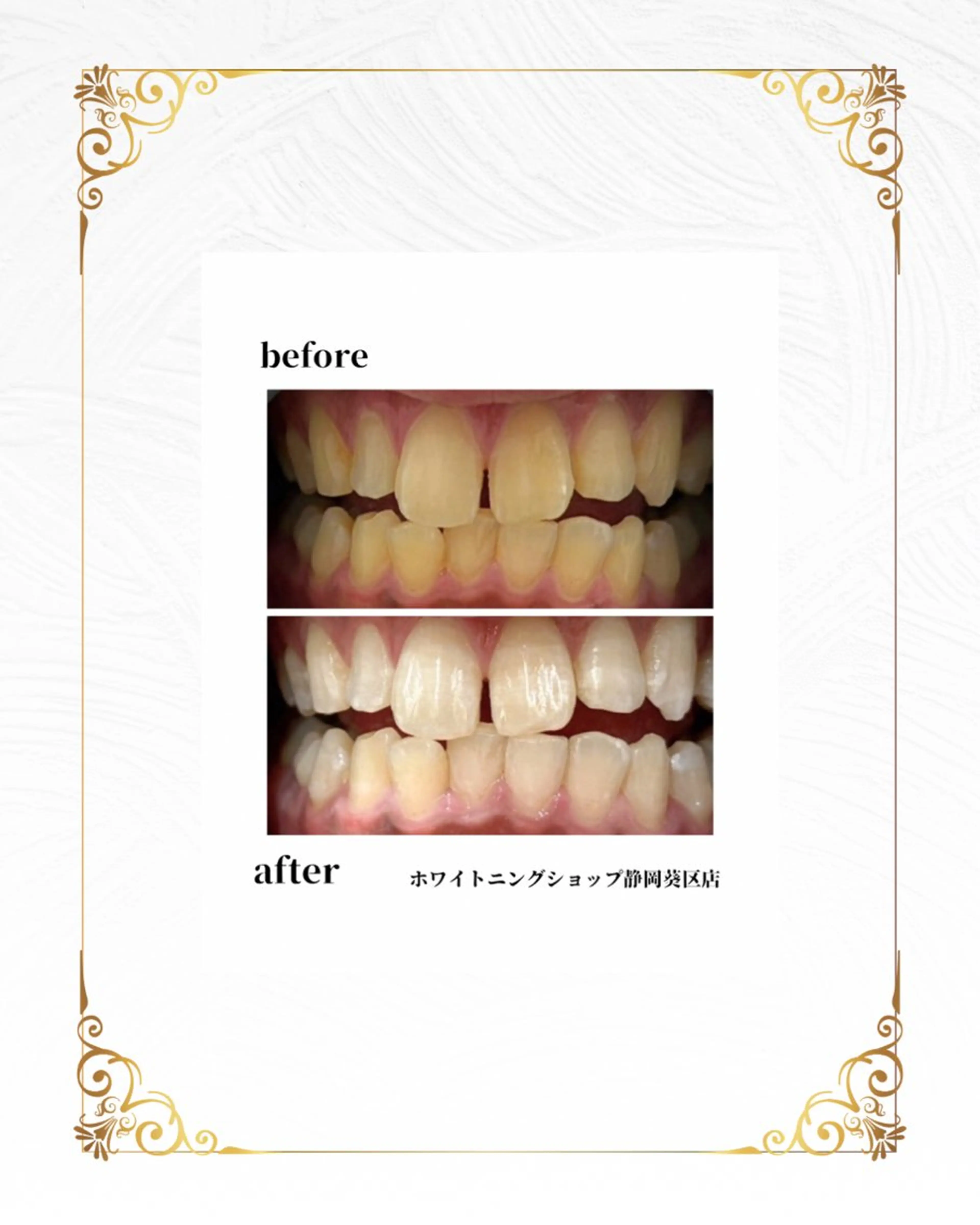 その他 ホワイトニング ショップ葵区静岡駅店のその他イメージ