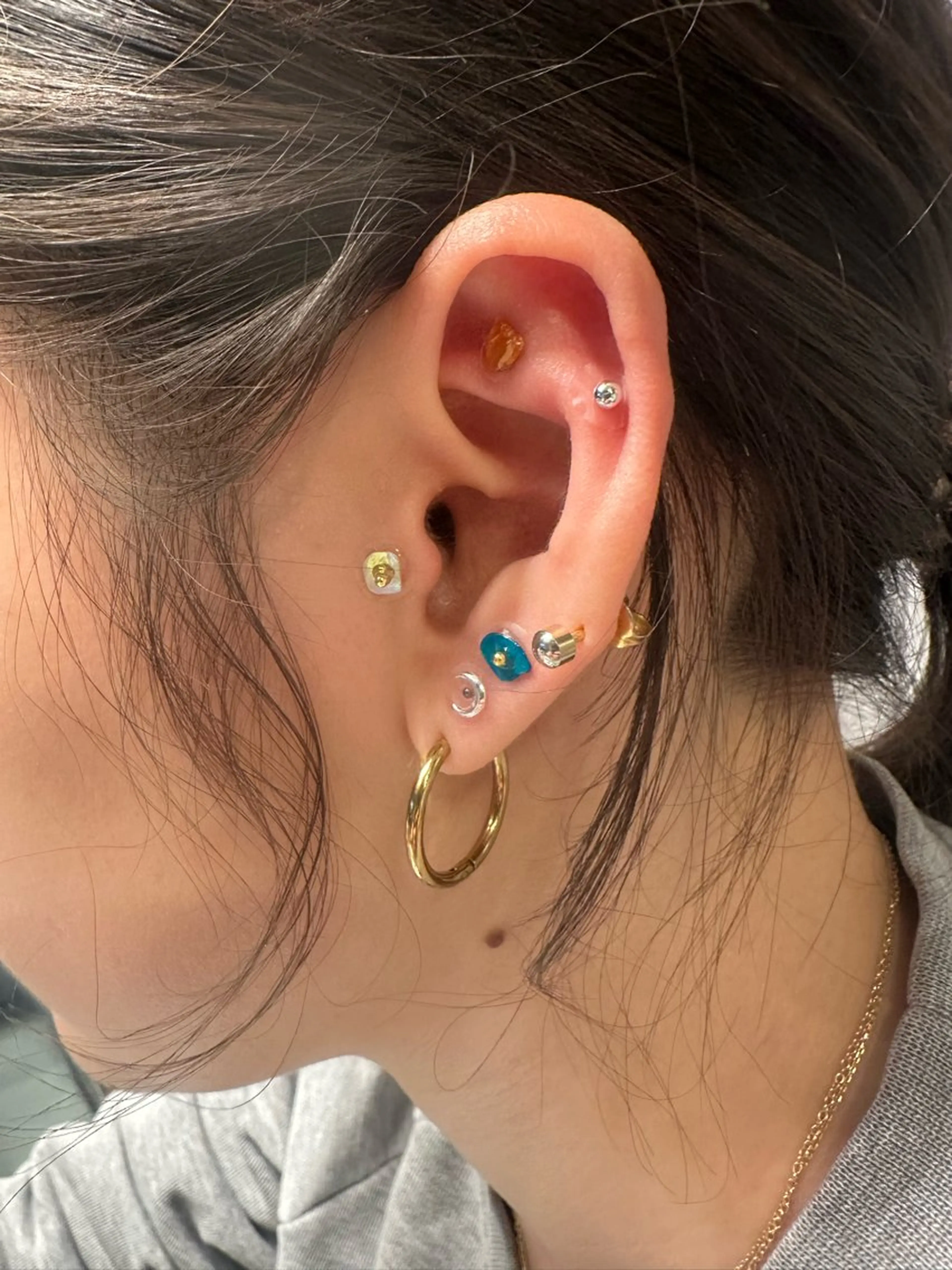 -  y i n  y a n g　.  -所属・美容鍼灸サロン yin yangのその他イメージ