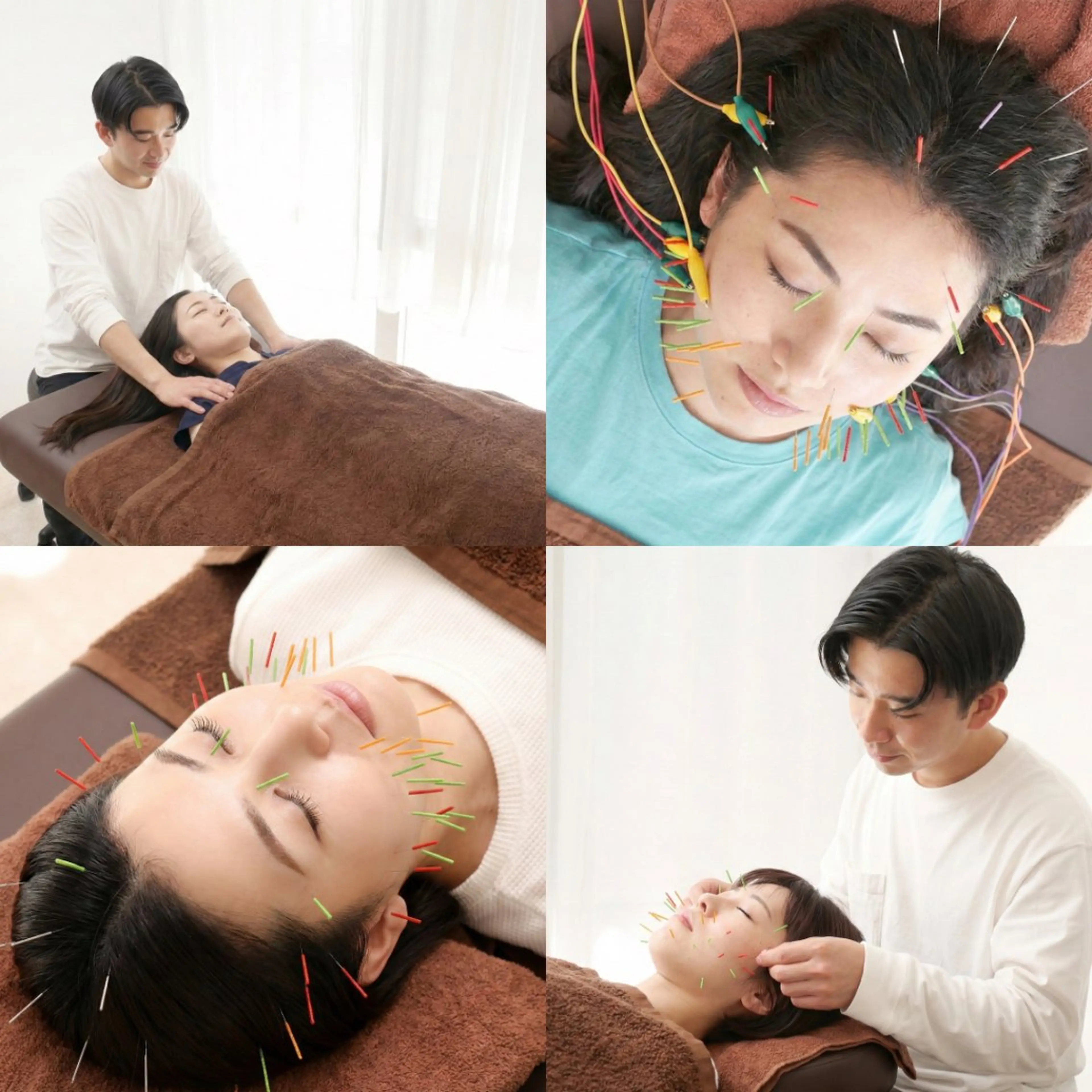 美容鍼DAZZLE マスザキのエステ・リラクイメージ