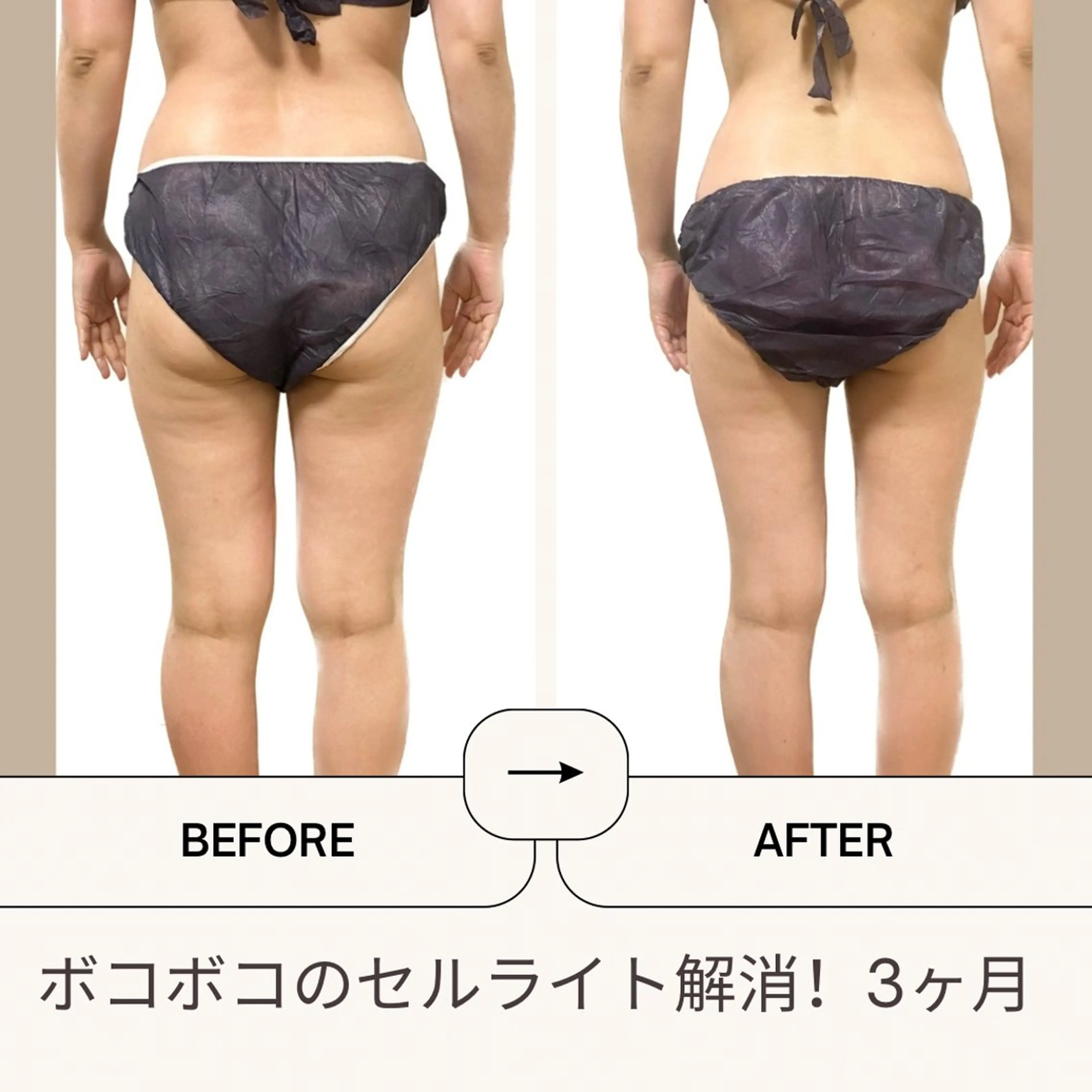 エステ Welina  Pono beauty salon所属・加藤 美有のエステ・リラクイメージ