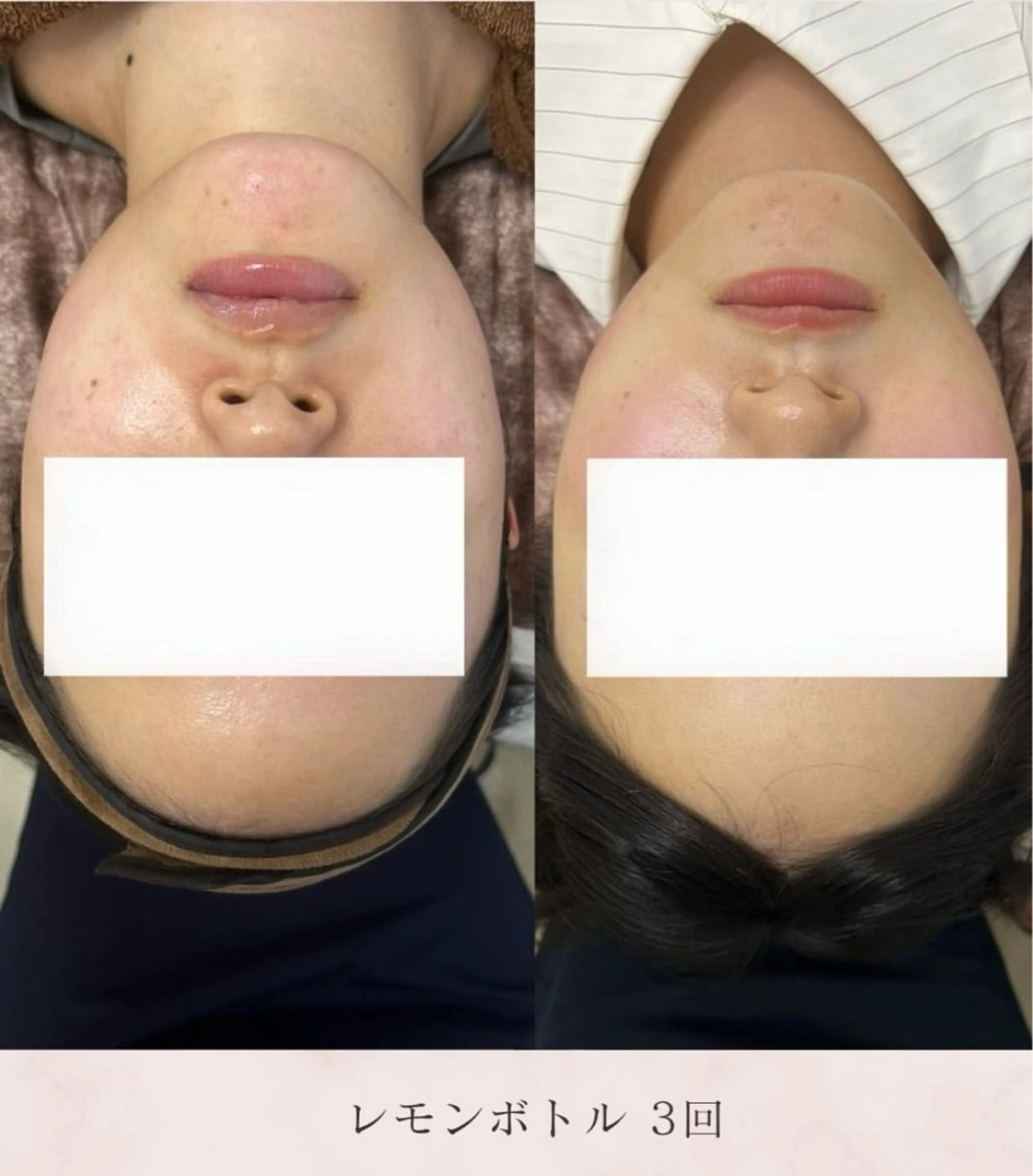 エステ 看護師が施術する美容 ナスサロshokoのエステ・リラクイメージ