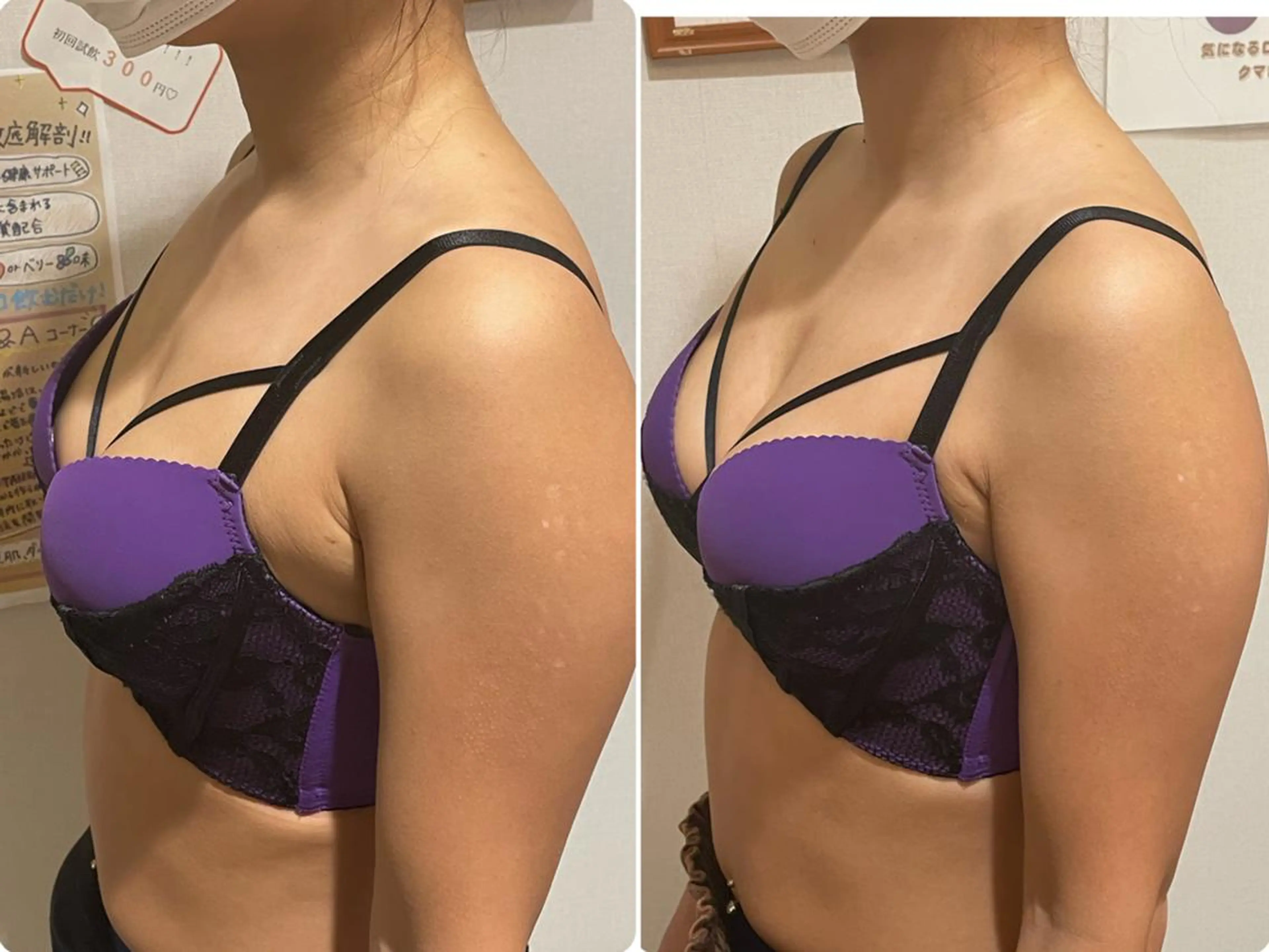 エステ リラク 🎀美肌ケアサロン 🎀レイビス銀座店のエステ・リラクイメージ