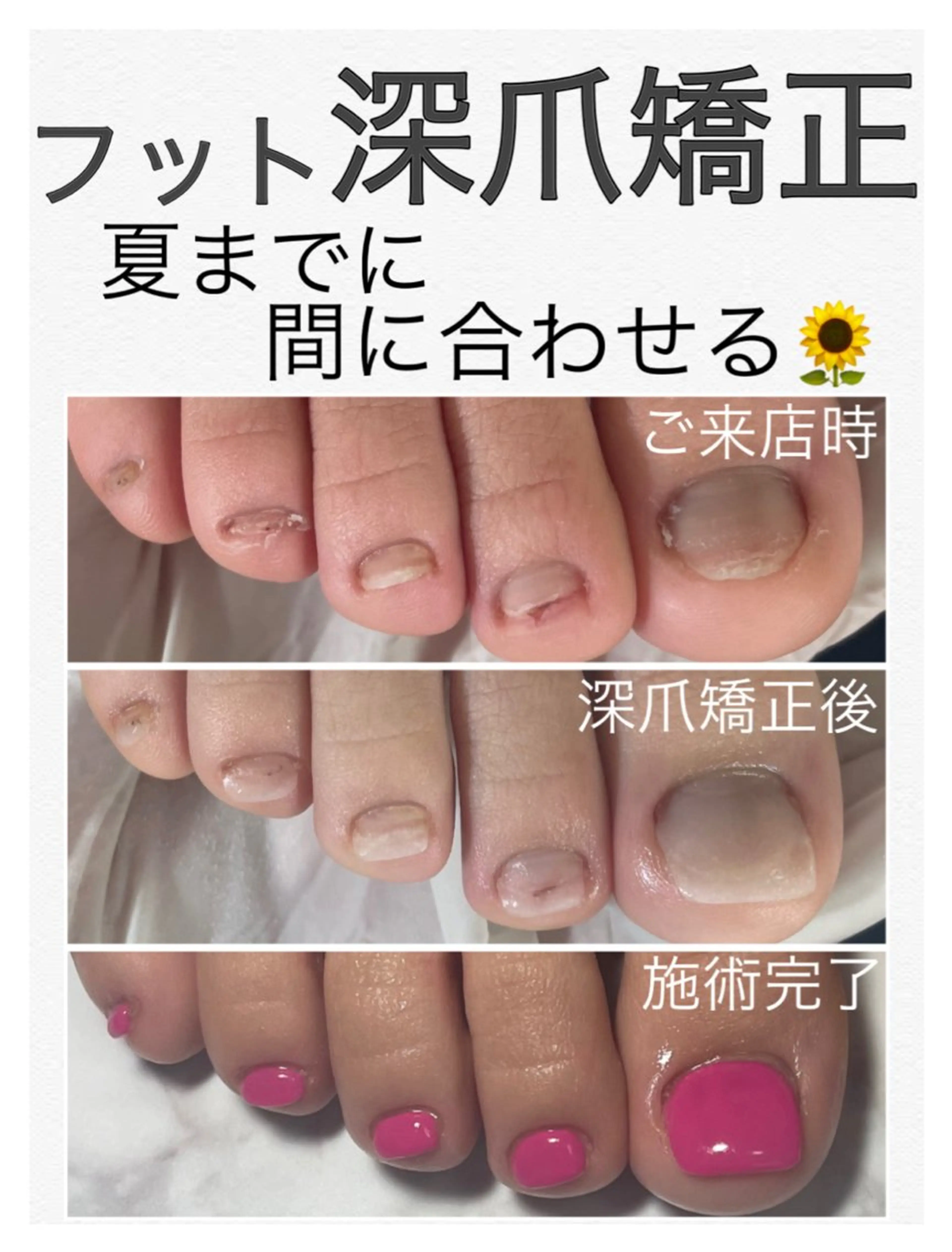 ネイル フットネイル nail salon petillantのネイルデザイン