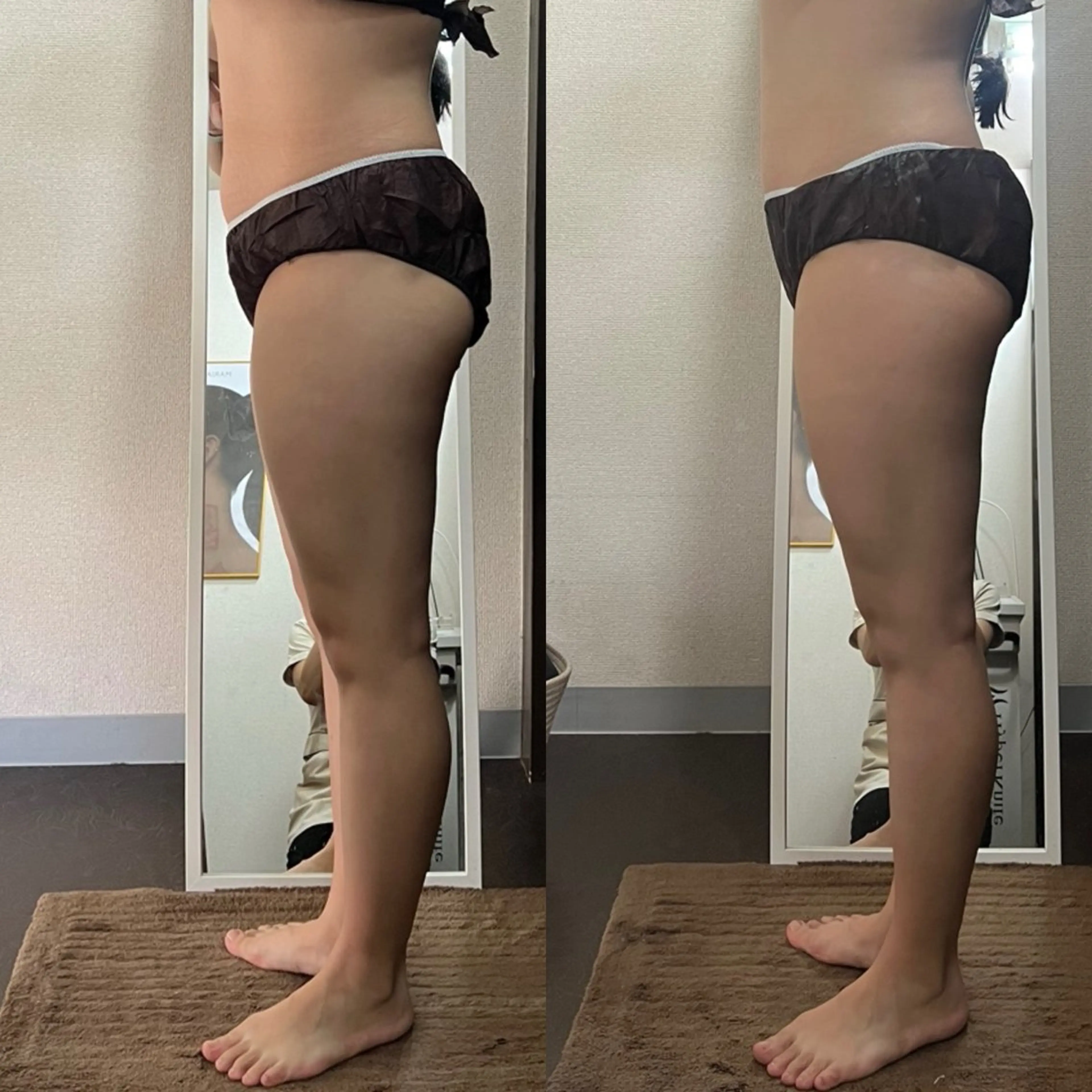 ハイパーナイフ専門店　Salon de COCO所属・Salon de COCOのエステ・リラクイメージ