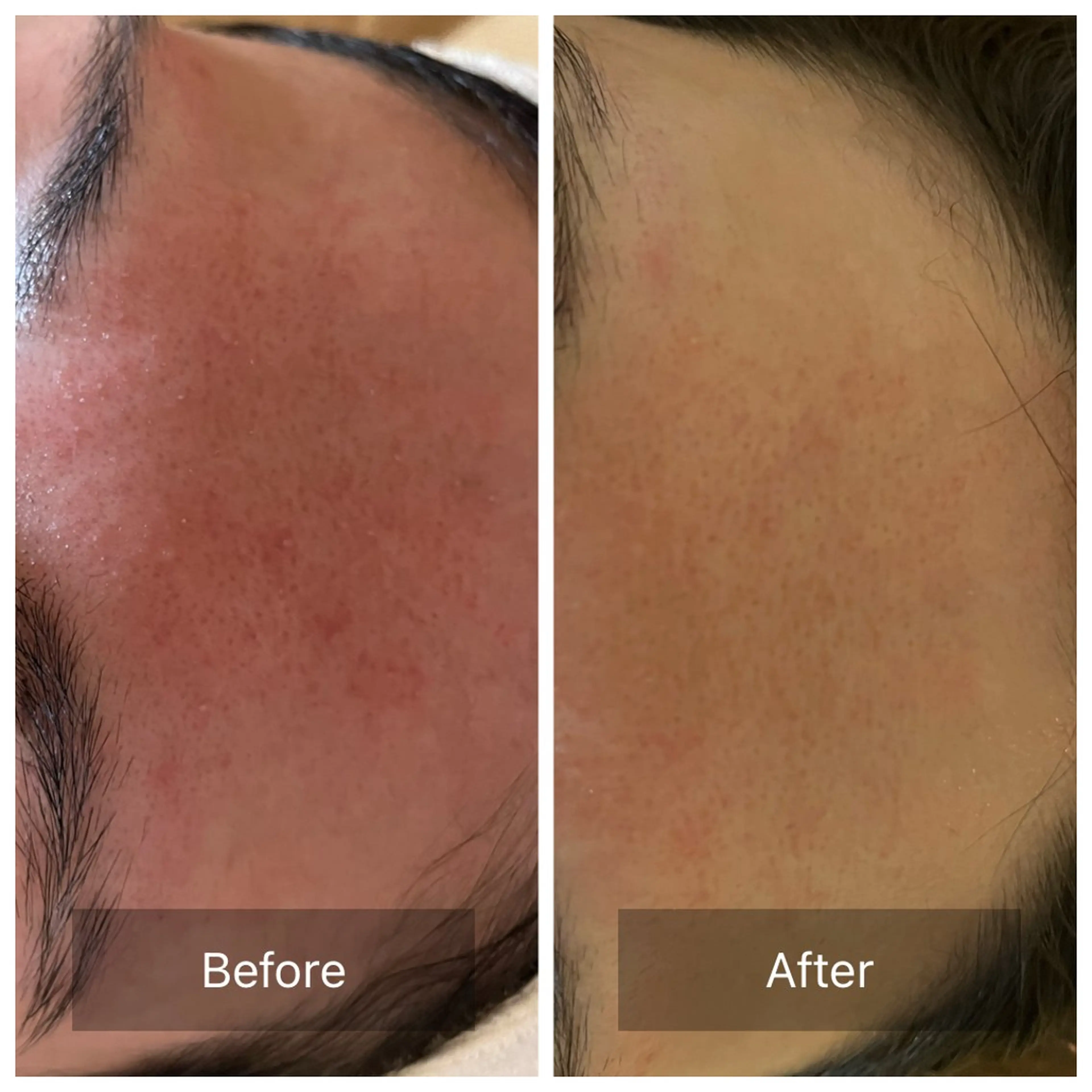 Empreinte (アンプラント)のエステ・リラクイメージ