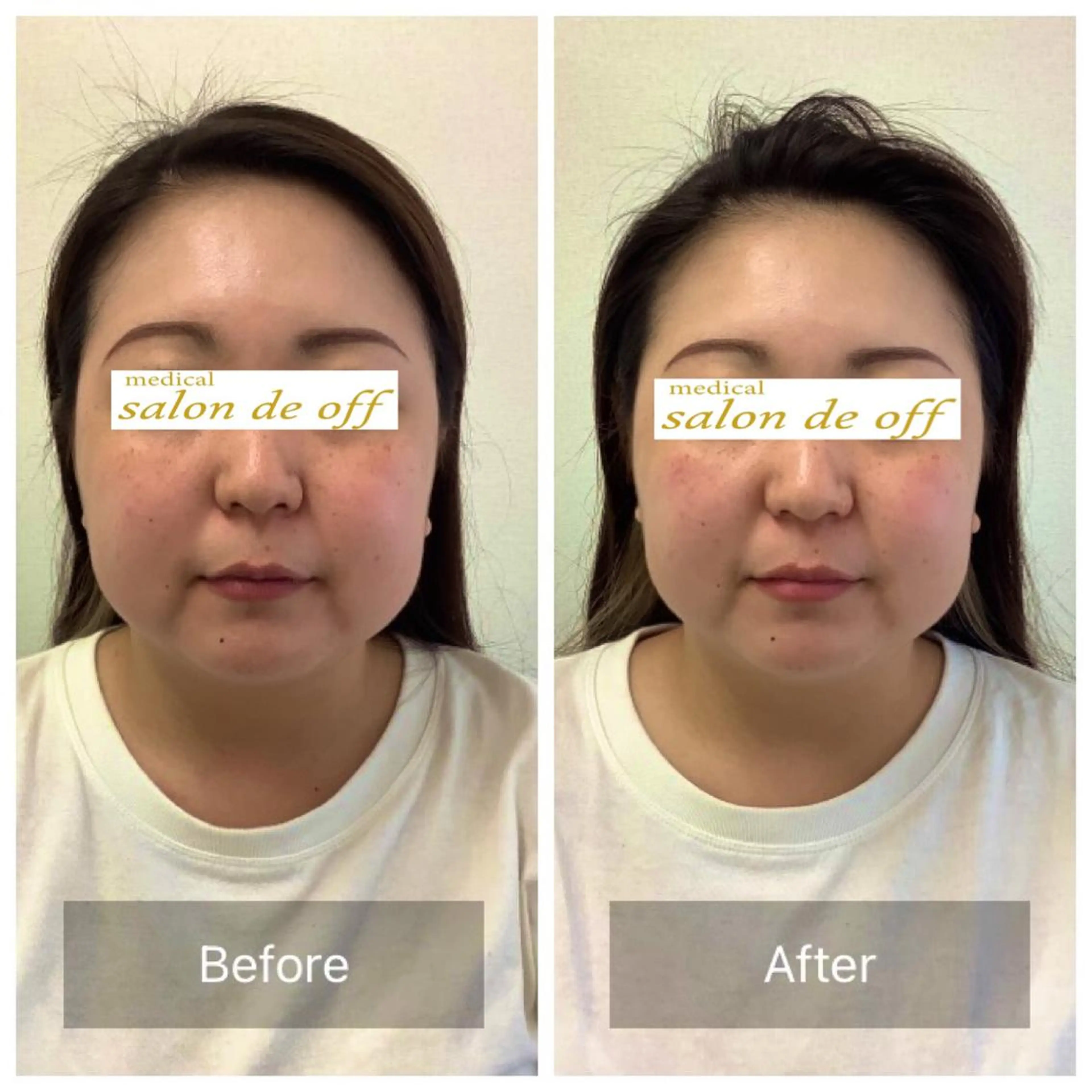 メディカルサロンドオフ所属・ハリサロンドオフ 美容鍼灸×小顔整体のエステ・リラクイメージ