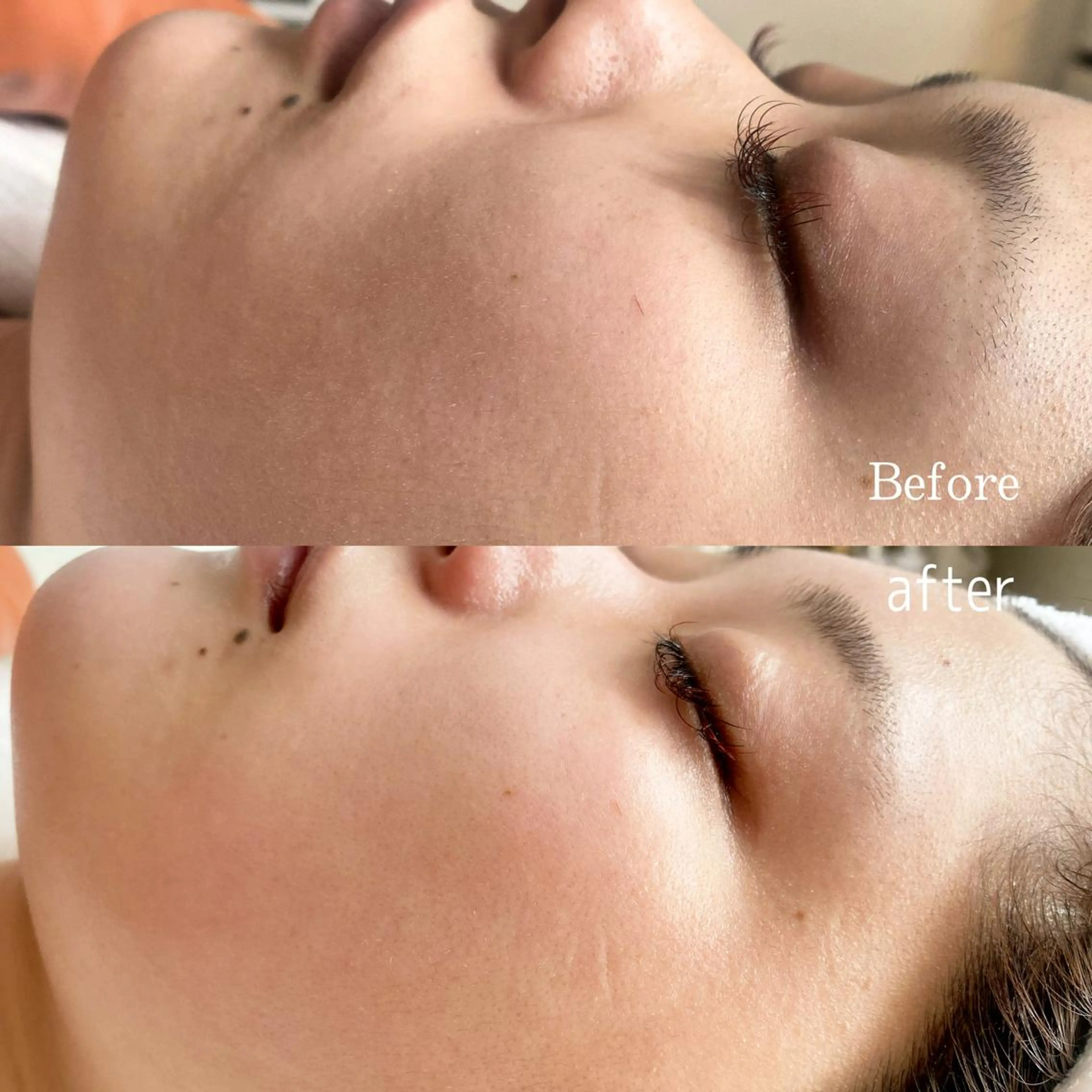 エステ リラク 整♡深層リンパ ronronのその他イメージ