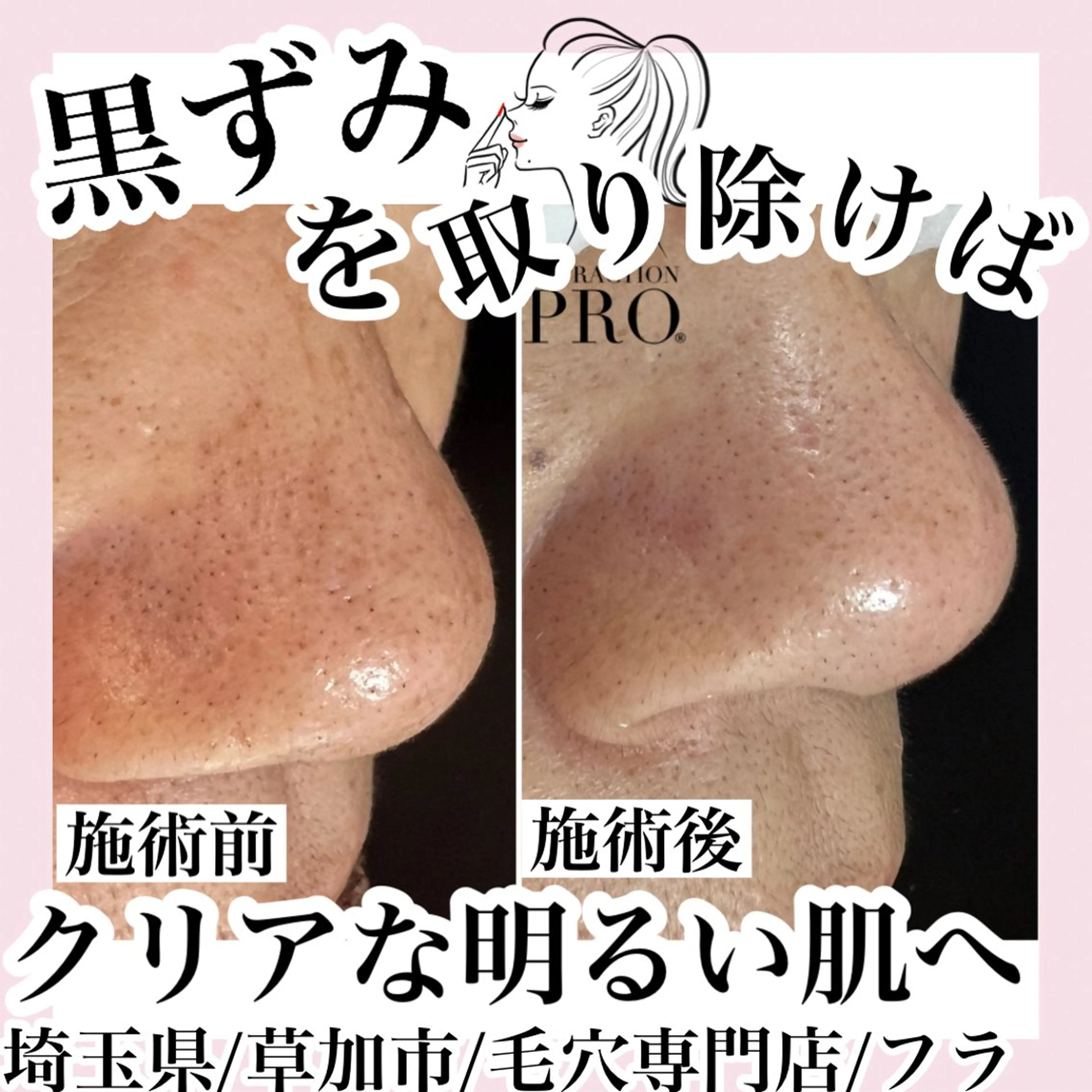 エステ 毛穴専門店hula 杉山智美のエステ・リラクイメージ