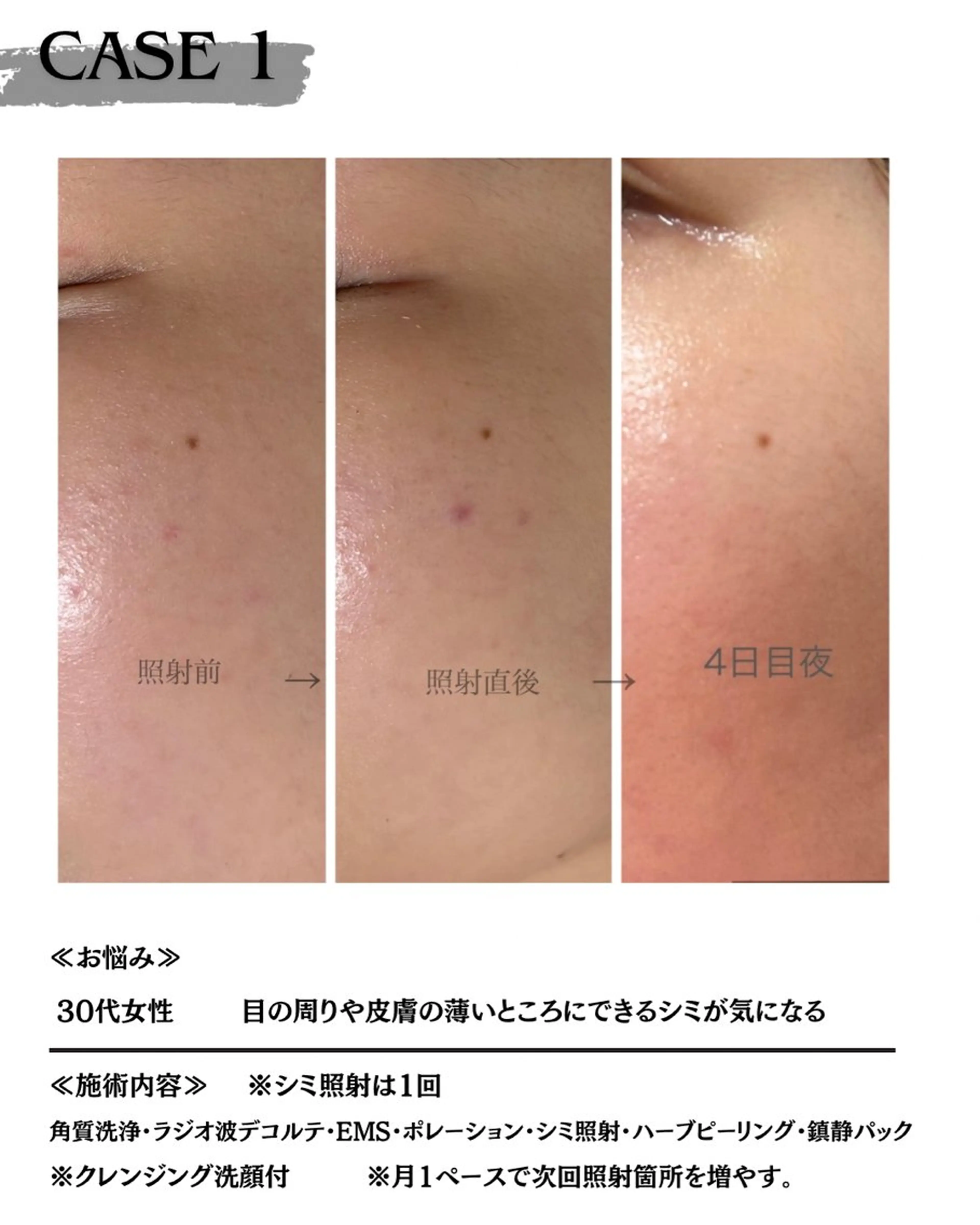【医療提携サロン】 【シミケア専門】のエステ・リラクイメージ
