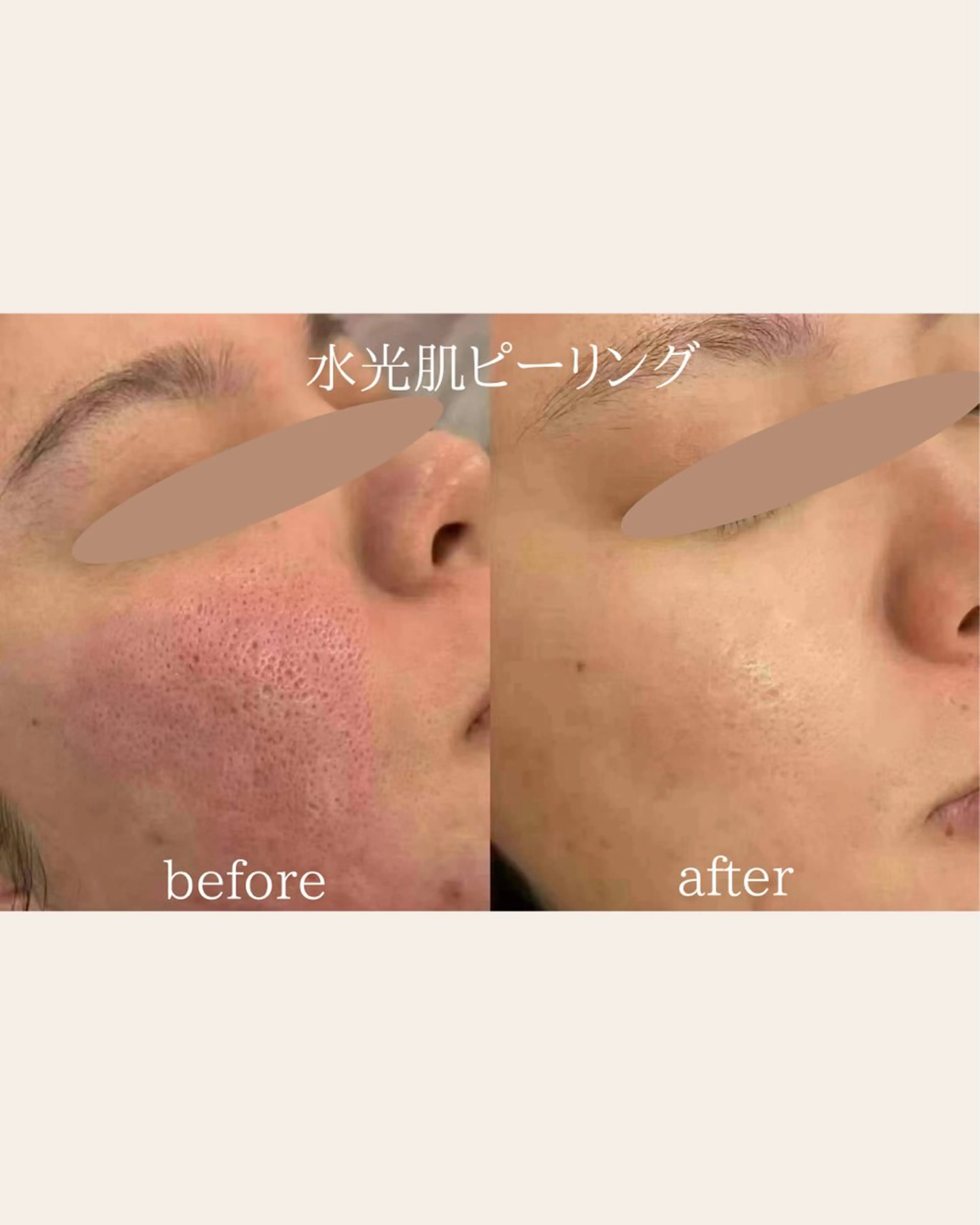 美腸サロン🌺 腸もみ/小顔/リンパのエステ・リラクイメージ