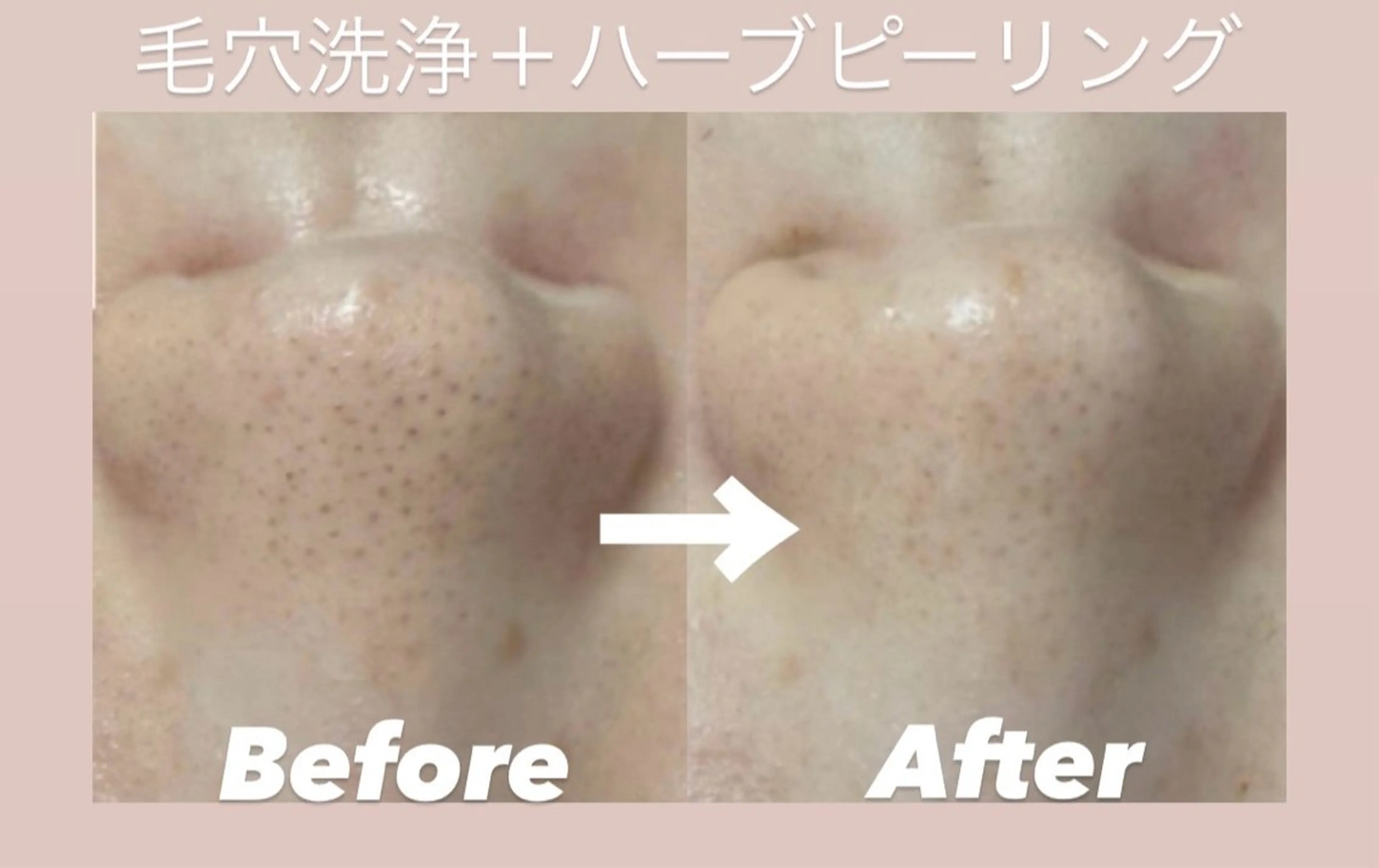 韓国肌管理Belle堀江所属・韓国肌管理 Belle堀江のエステ・リラクイメージ