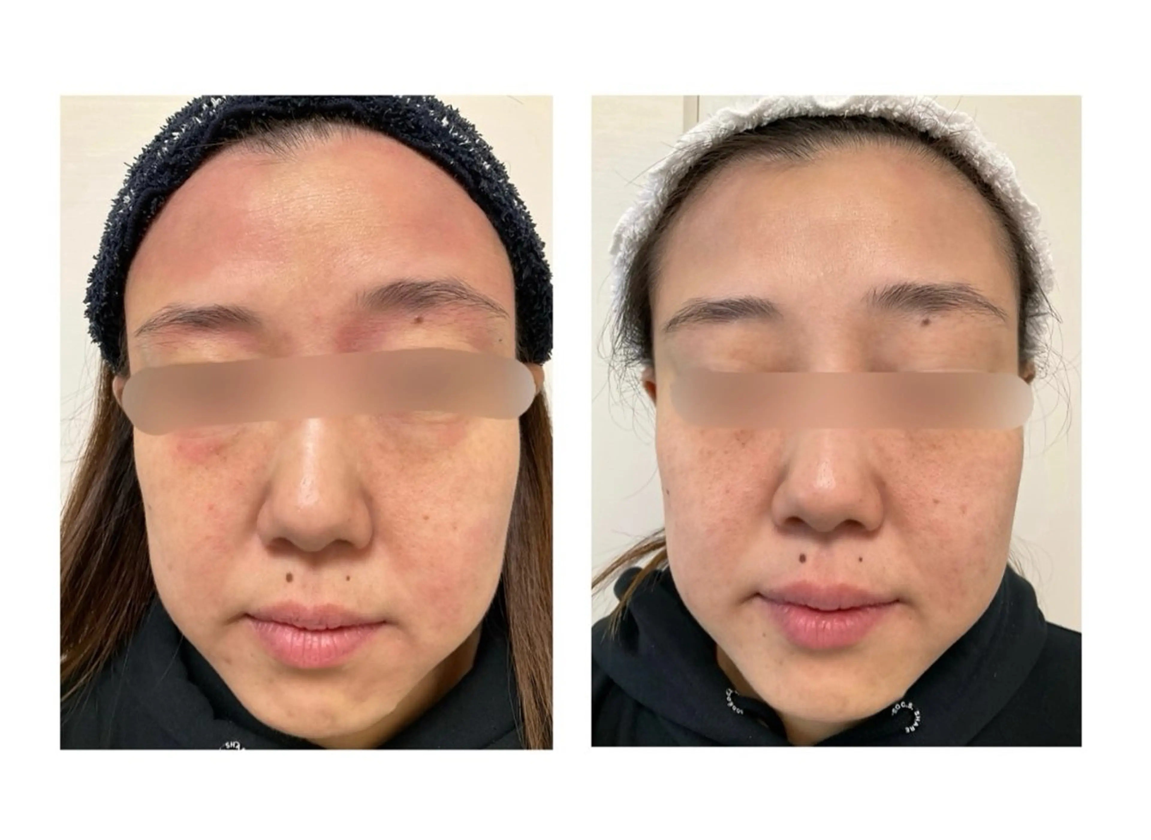 Belchic ベルシックのエステ・リラクイメージ