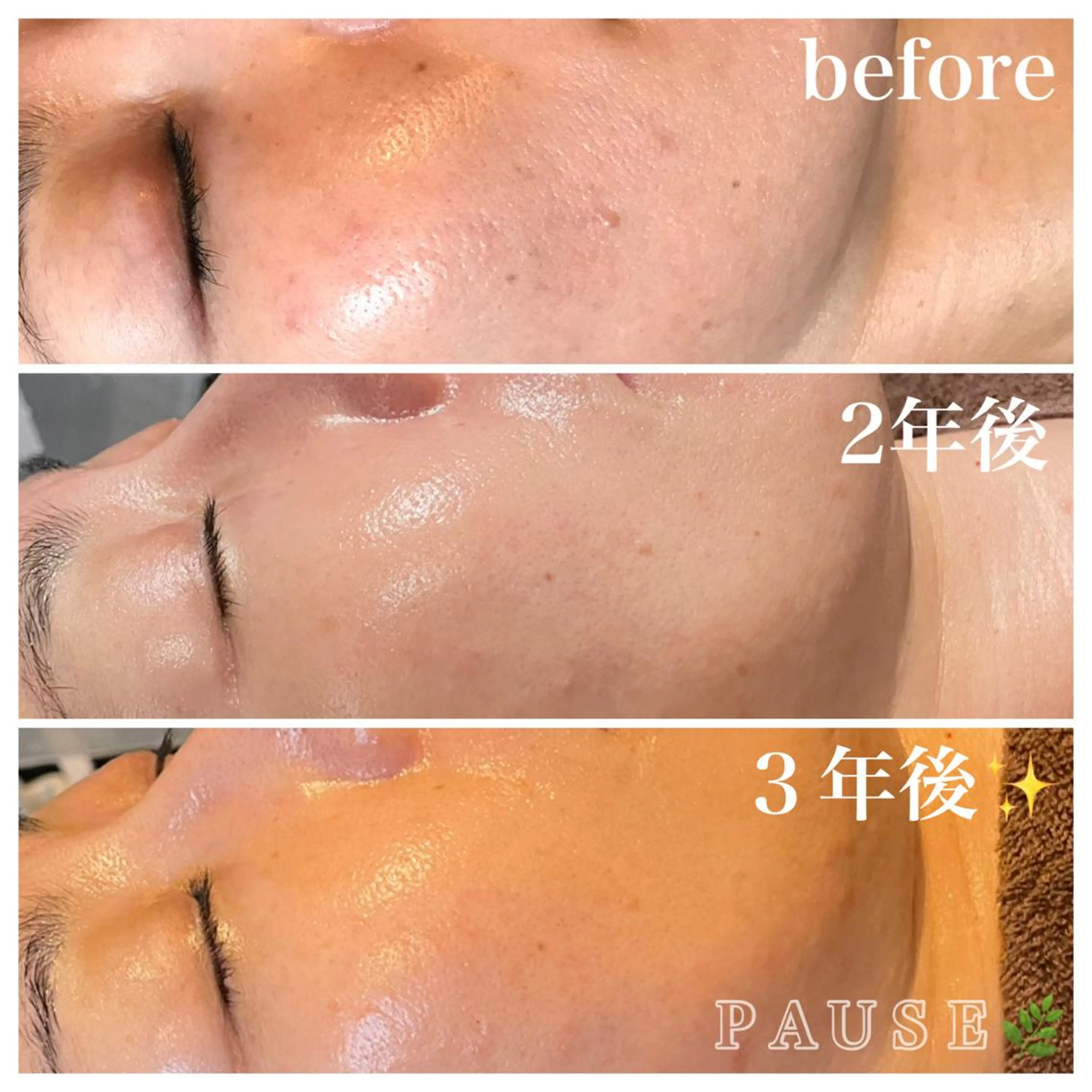 エステ 浜野 恵美のエステ・リラクイメージ