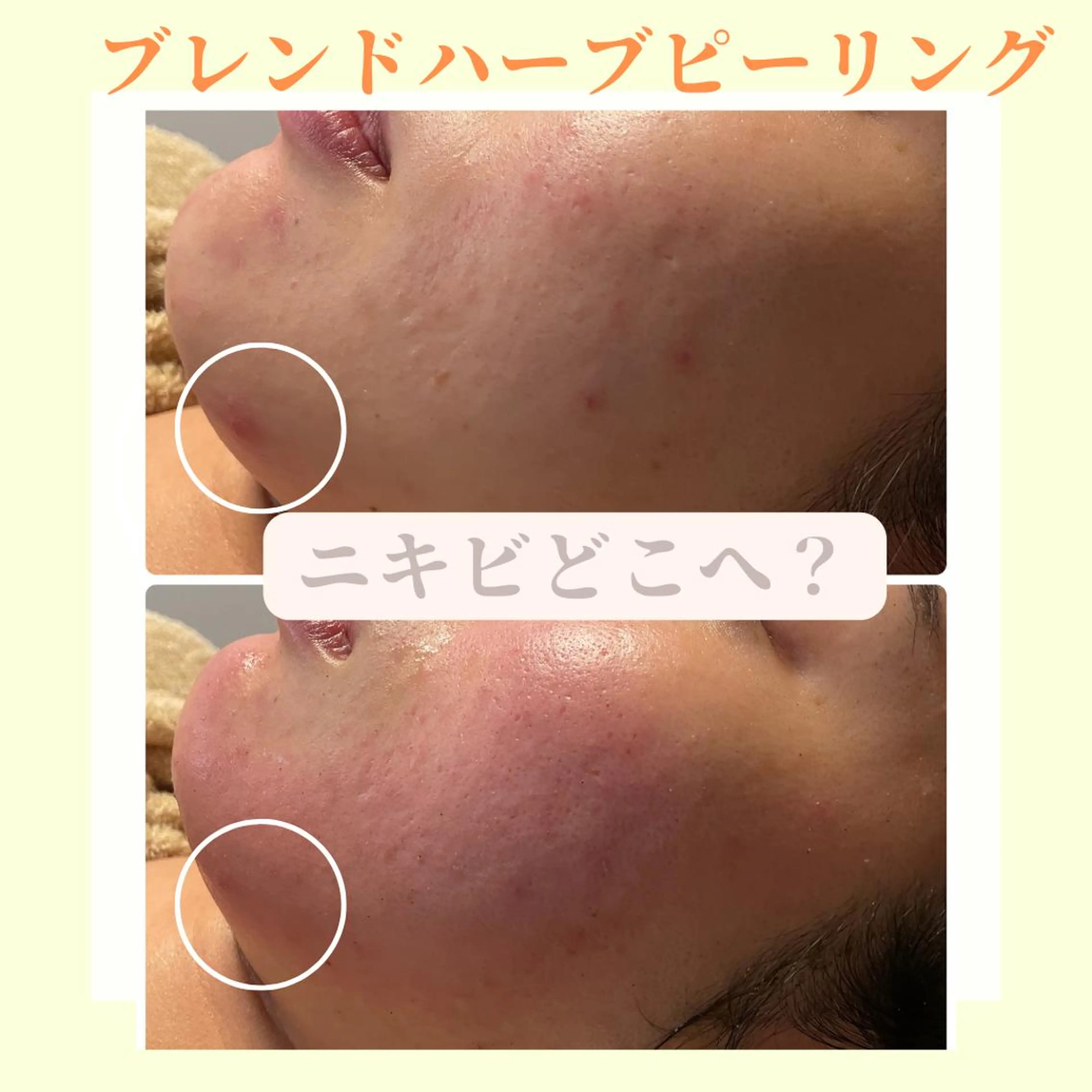 エステ リラク ピーリング専門店 Belluteのエステ・リラクイメージ