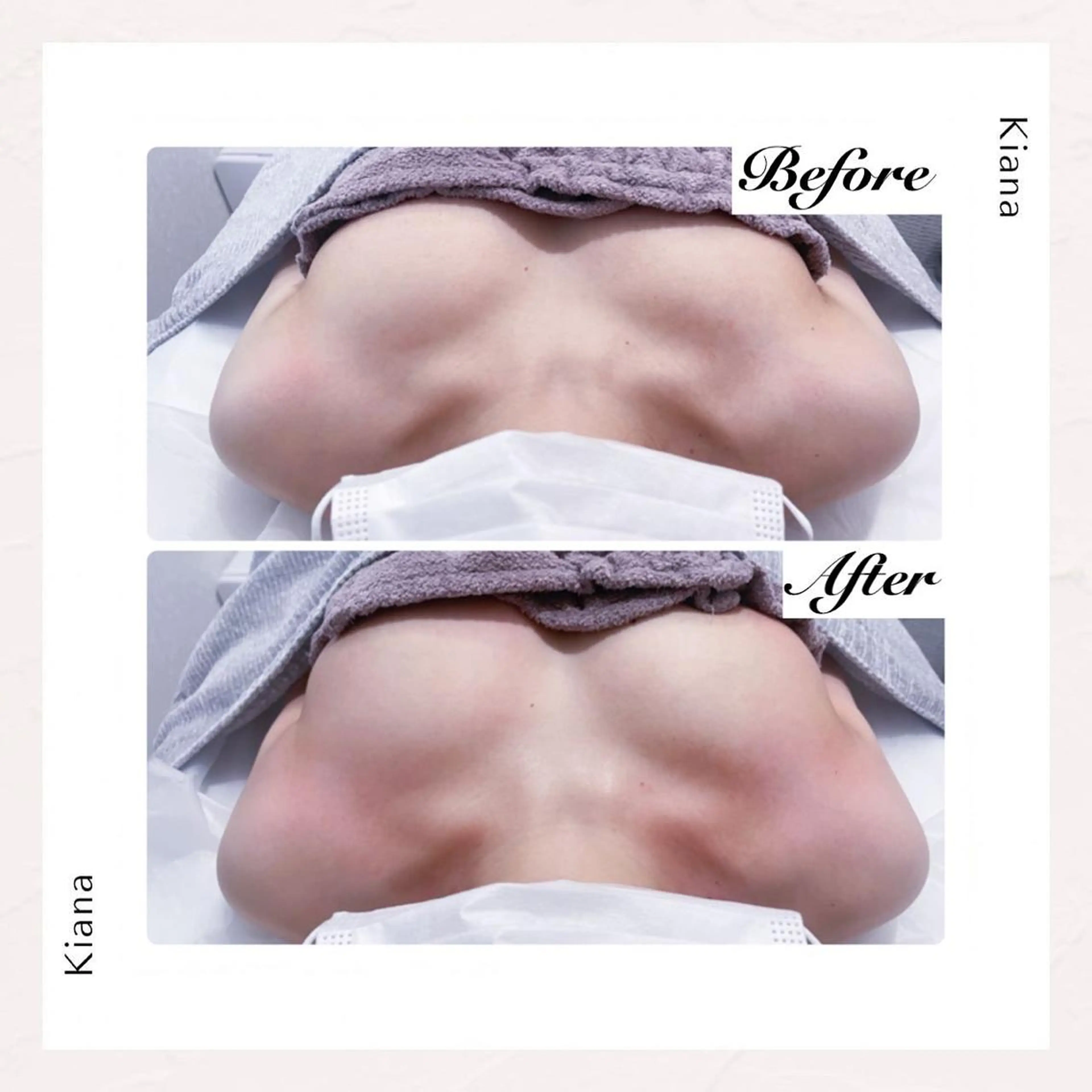 エステ リラク バスト専門Kiana 風のエステ・リラクイメージ