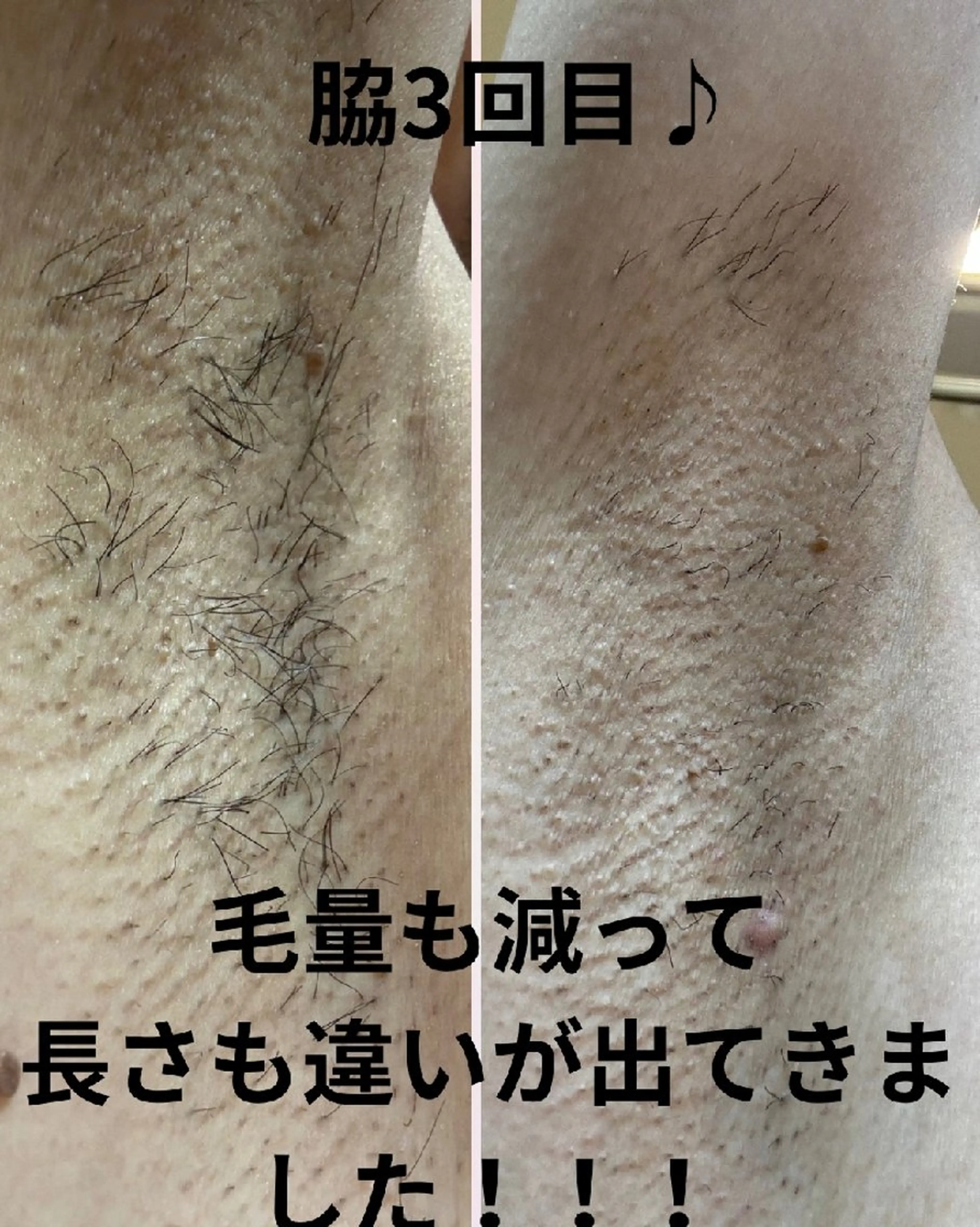 macheriena りなのエステ・リラクイメージ