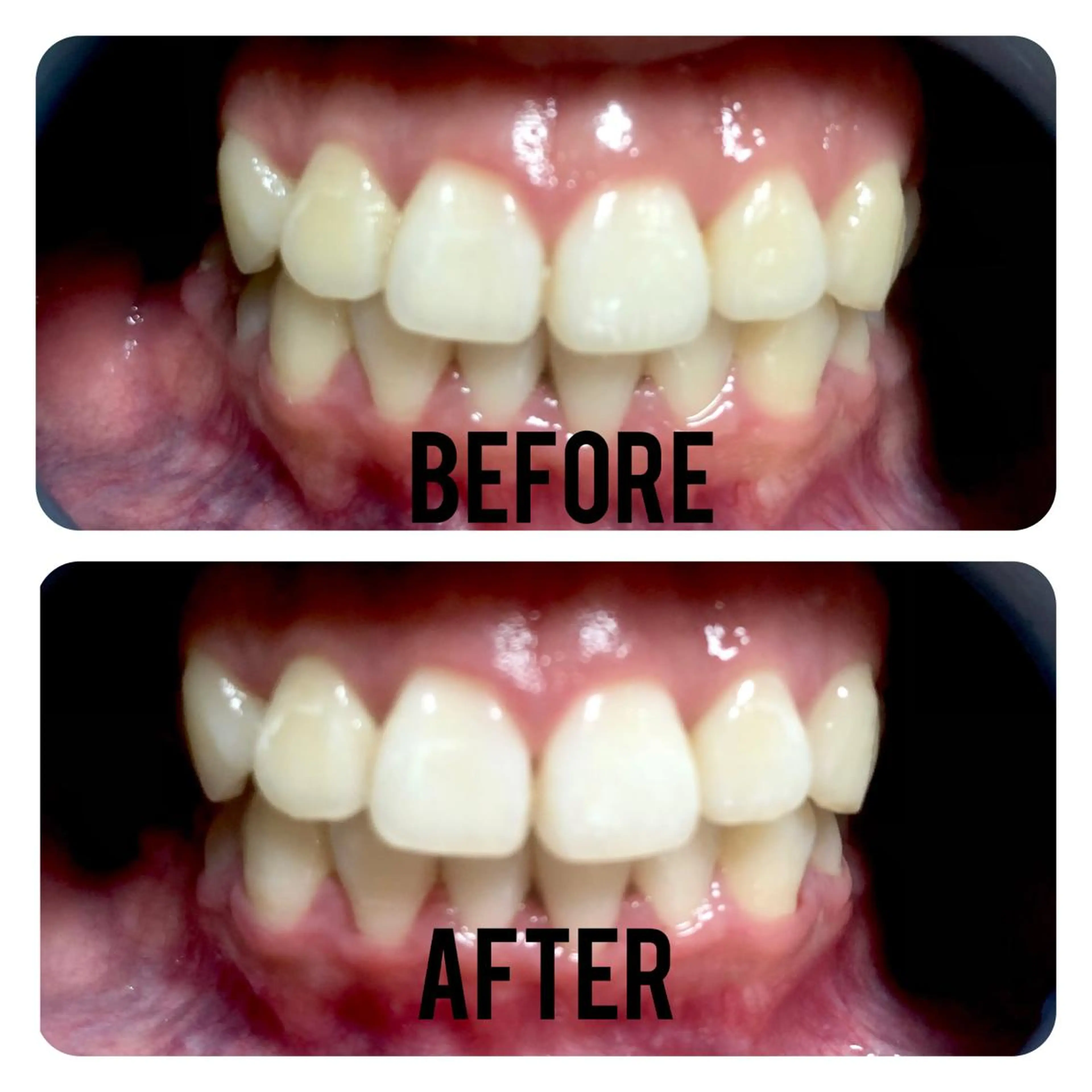 その他 two nailのネイルデザイン